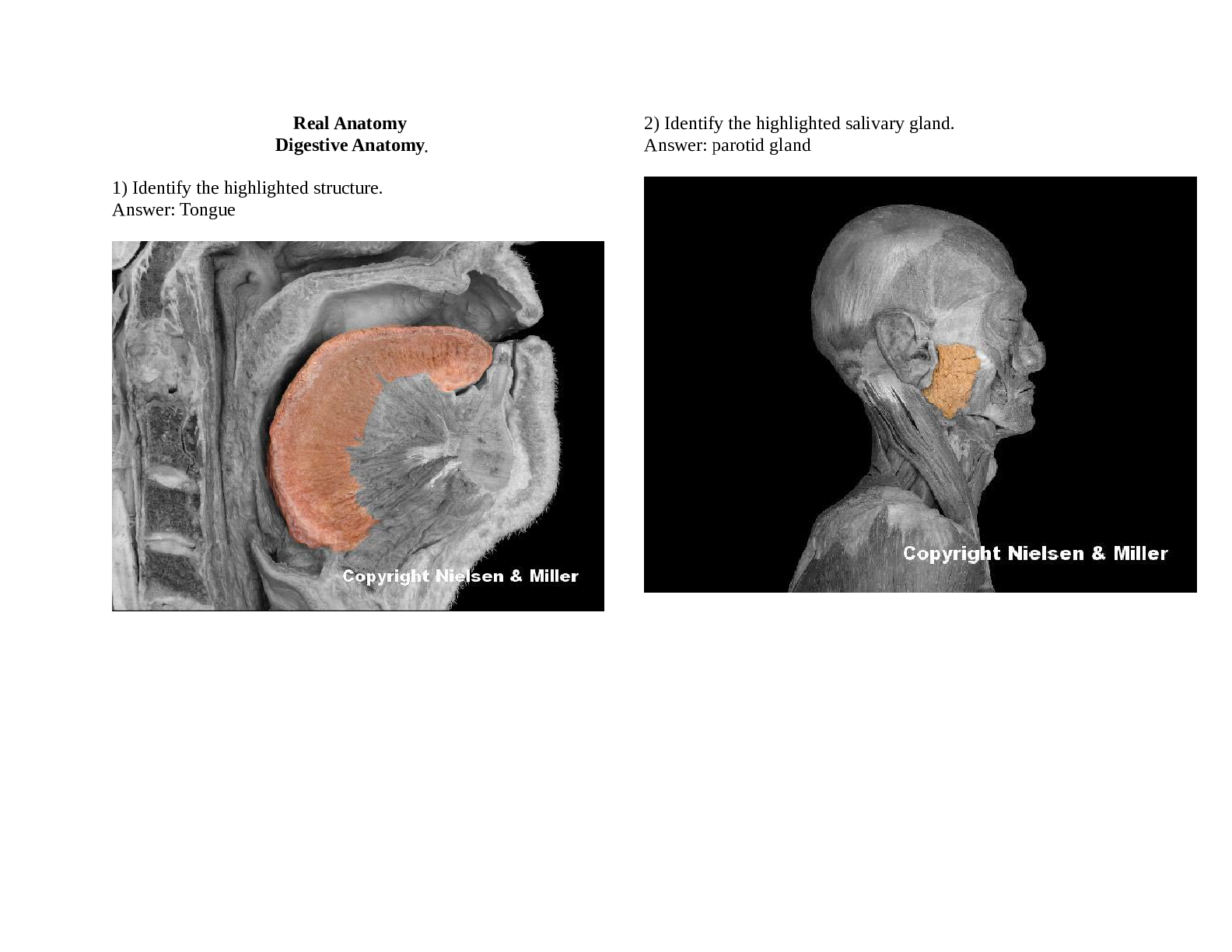 Preview of BIO 206 Digestive System - Lab Assignment.docx