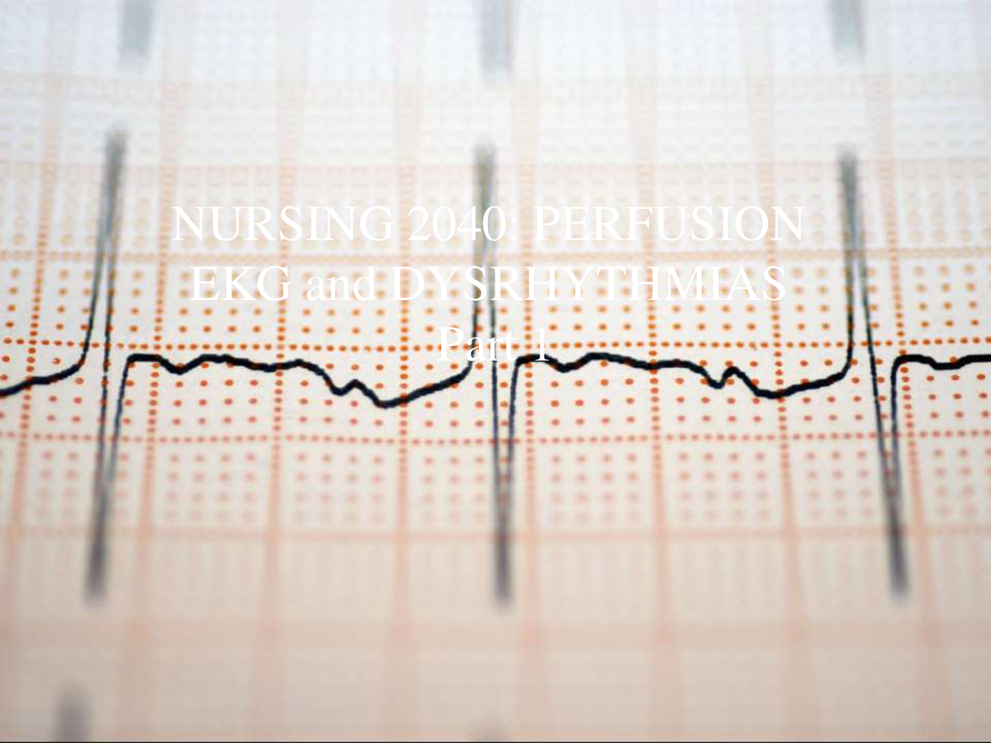 Preview of NURSING 2040:PERFUSION EKG and DYSRHYTHMIAS Part 1