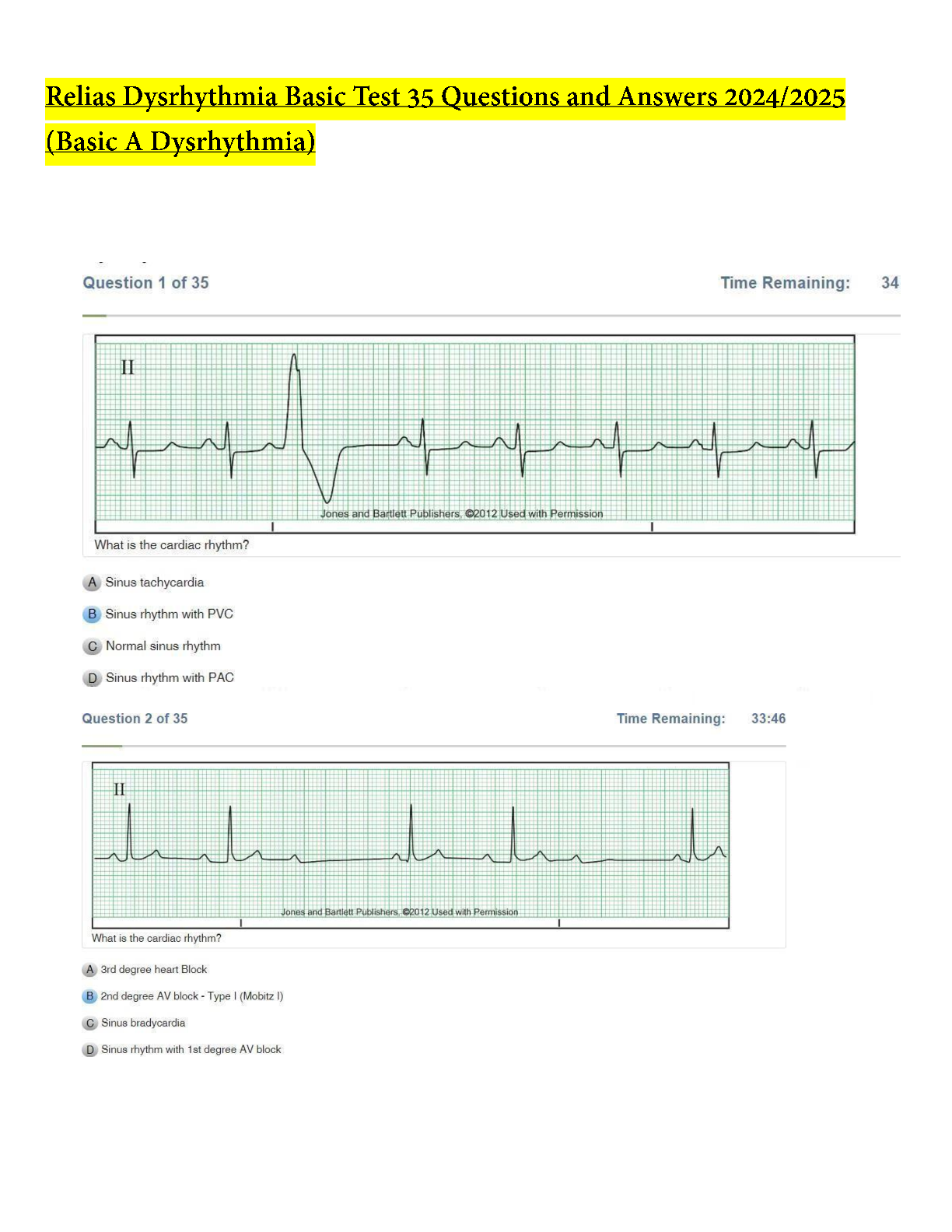 Preview image for Relias Dysrhythmia Basic Test 35 Questions and Answers 2023 (Basic A Dysrhythmia)