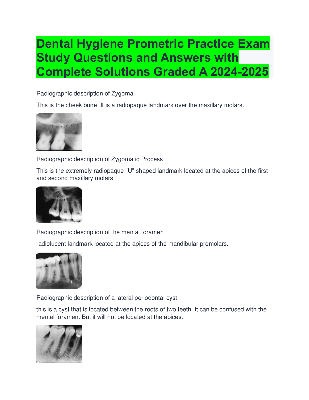 Preview of Dental Hygiene Prometric Practice Exam Study Questions and Answers with Complete Solutions