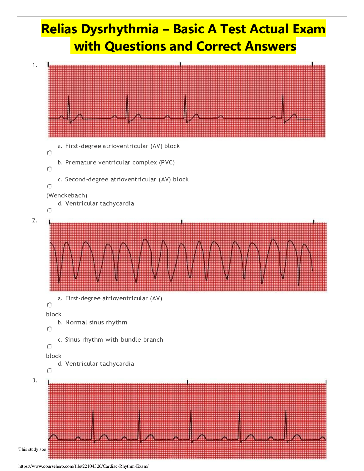 Relias Dysrhythmia – Basic A Test Actual Exam with Questions and Correct Answers