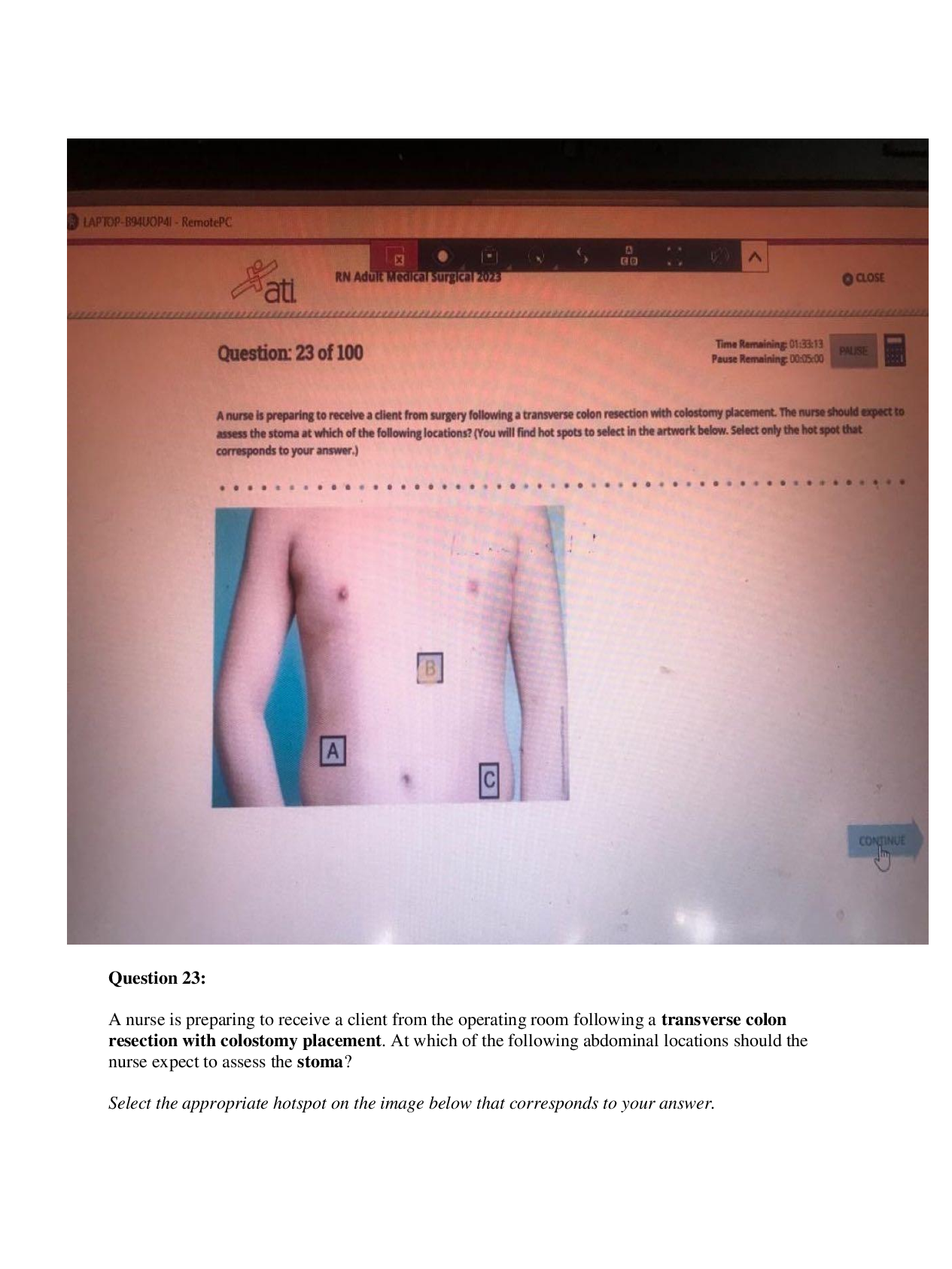 Preview image for ATI Medical-Surgical Proctored Exam 2023 | NGN Format | 100 Complete Questions & Verified Answers