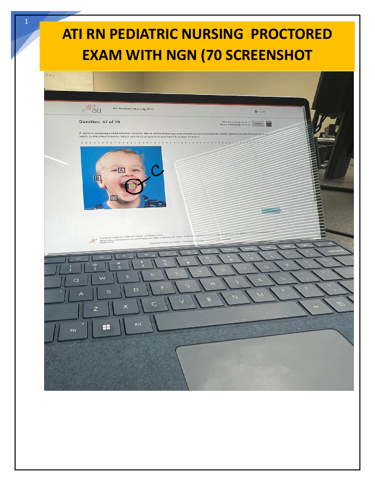 Preview image for Actual RN ATI Pediatric Proctored Exam with All 70 Questions and 100% Verified Answers with Rationales – ATI RN Pediatric Nursing Proctored Exam with NGN 2023-2025