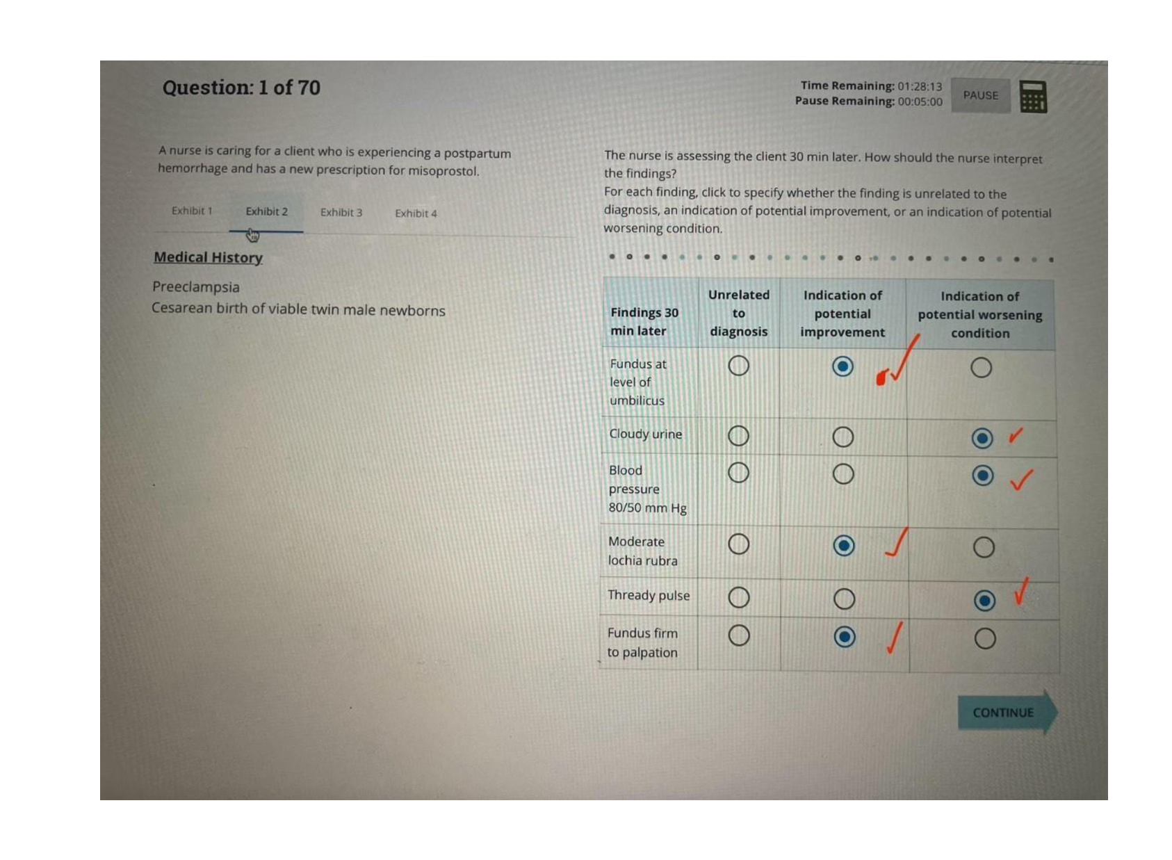 Preview image for RN Maternal Nursing OB Newborn 2023 2024 Exam (5 versions Combined).