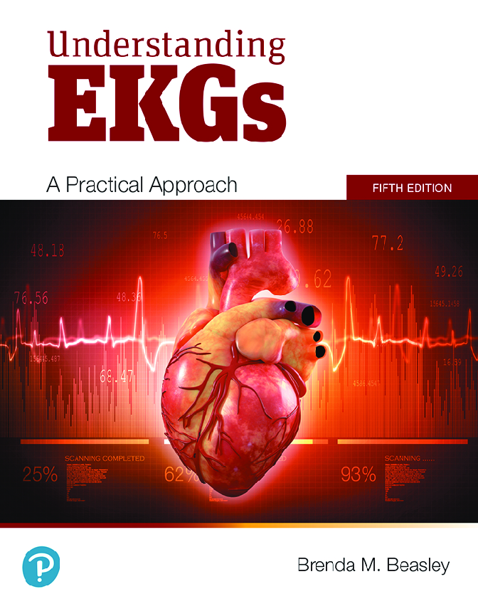 Preview of Understanding EKGs A Practical Approach 5th Edition By Brenda Beasley