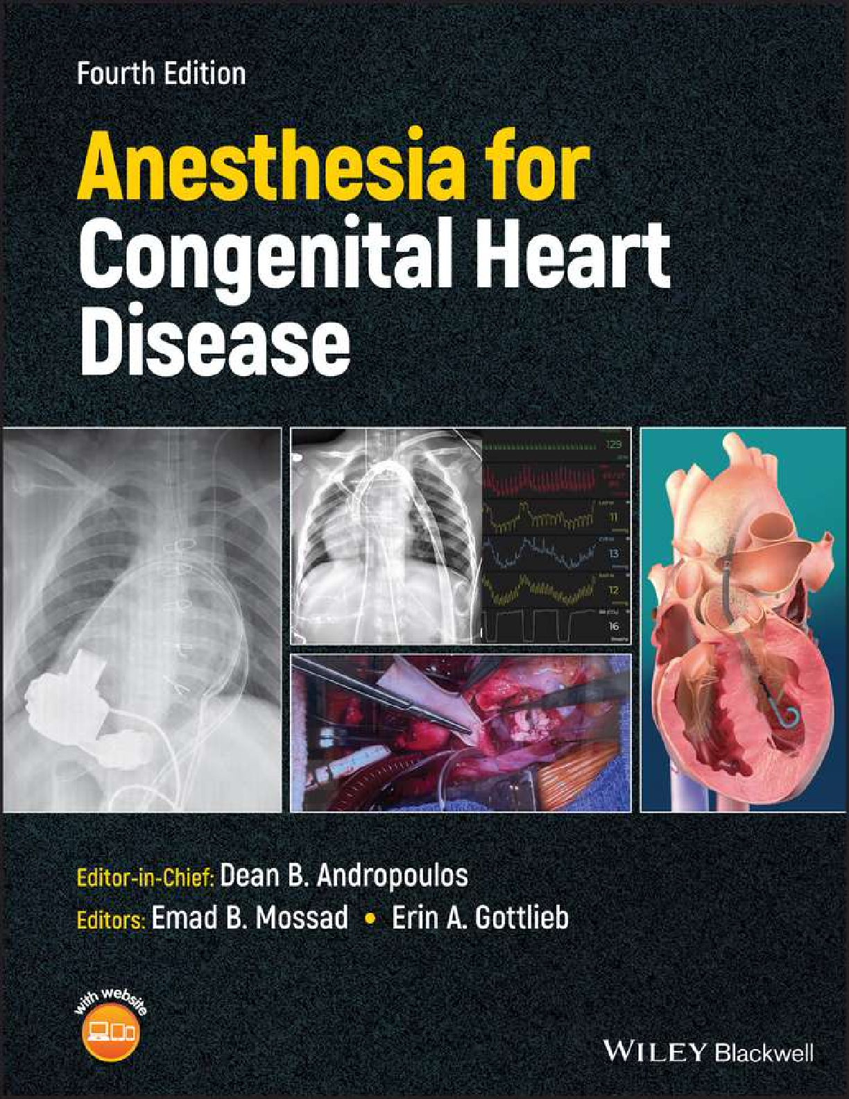 Preview of [eBook] (EPUB) [PDF] Anesthesia for Congenital Heart Disease 4th Edition By Dean B. Androp