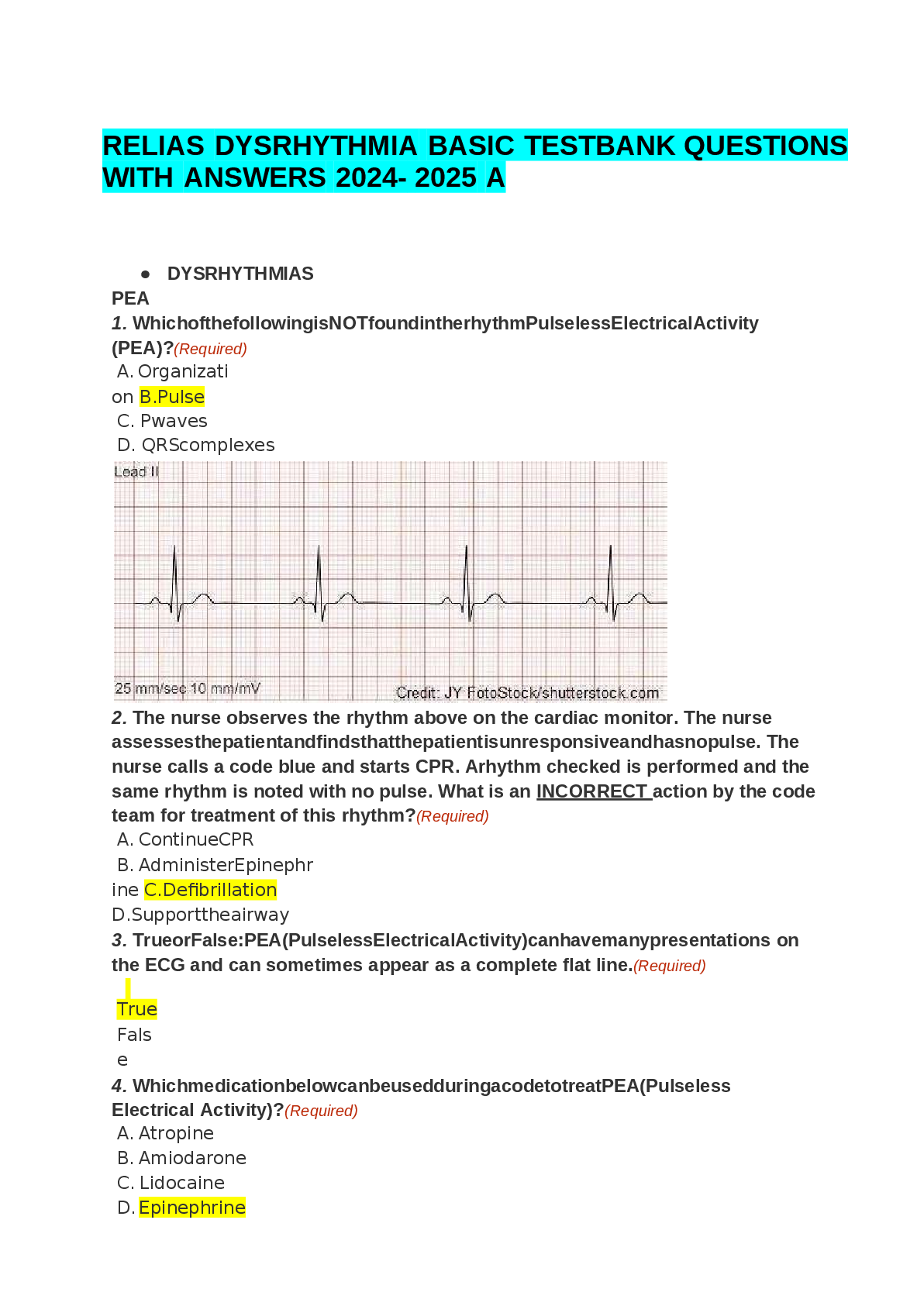 Preview image for RELIAS DYSRHYTHMIA BASIC TESTBANK QUESTIONS WITH ANSWERS 2024-2025 A