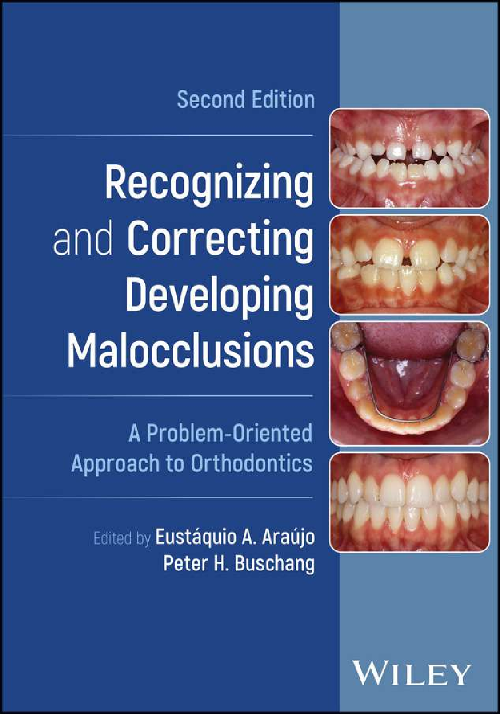 Preview image of eBook Recognizing and Correcting Developing Malocclusions A Problem-Oriented Approach to Orthodontics 2nd Edition By Eustáquio A. Araújo , Peter H. Buschang document