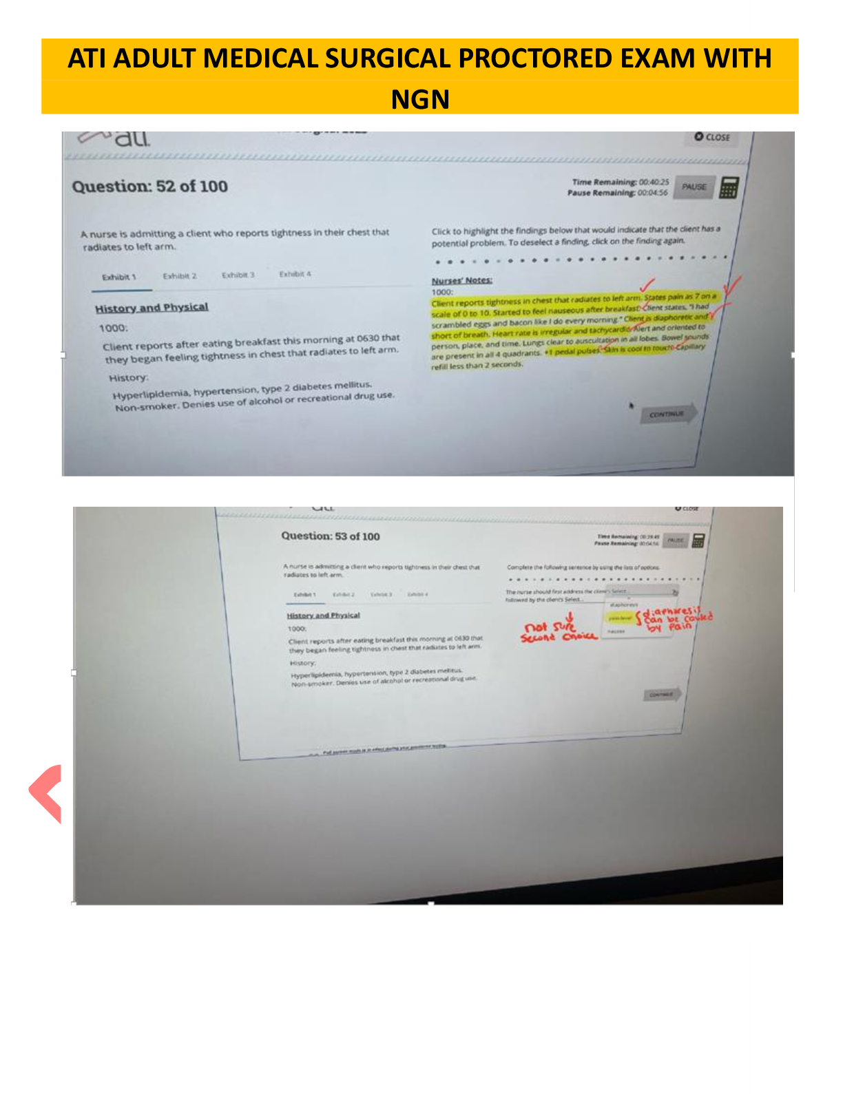 Preview image for ATI RN Adult Medical Surgical Proctored Exam 2025 with NGN