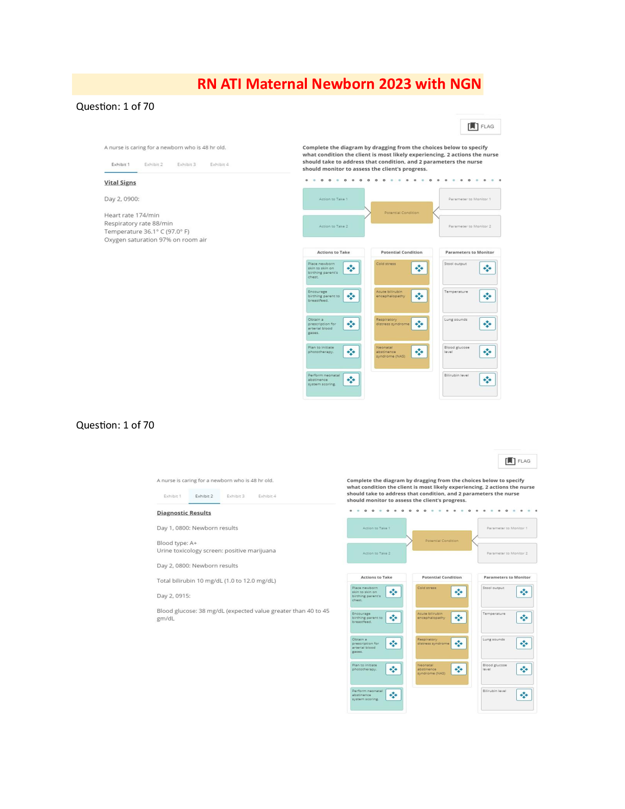 Preview of ATI RN MATERNAL PROCTORED RETAKE V2 EXAM 2023 WITH NGN (70 Questions)