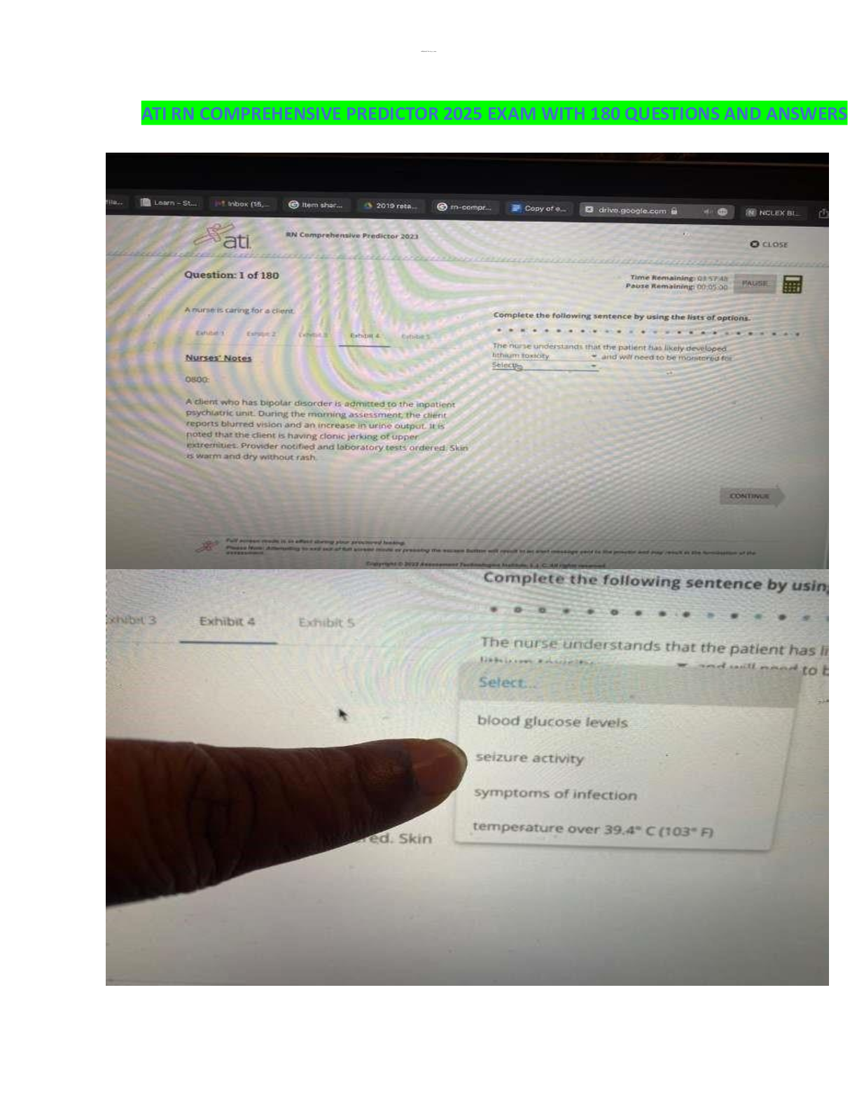 Preview image for RN Comprehensive Predictor Exit Exam Latest 2025: 180 Accurate Questions and Answers with Rationale