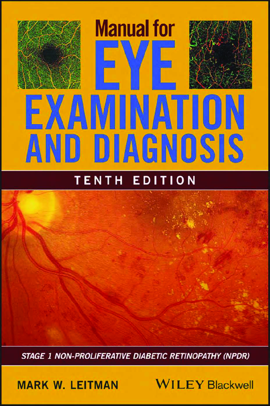Preview image for [eBook][PDF]  Manual for Eye Examination and Diagnosis 10th Edition By Mark W. Leitman