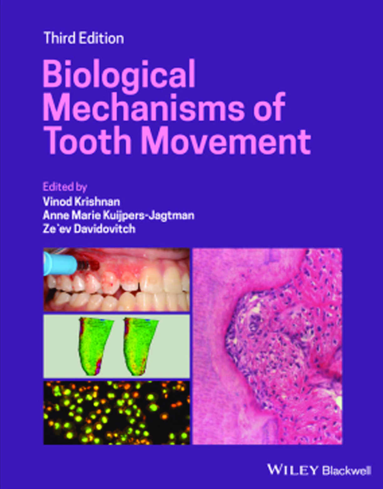 Preview image for [eBook] [PDF] Biological Mechanisms of Tooth Movement 3rd Edition By Vinod Krishnan, Anne Marie Kuijpers-Jagtman, Ze'ev Davidovitch