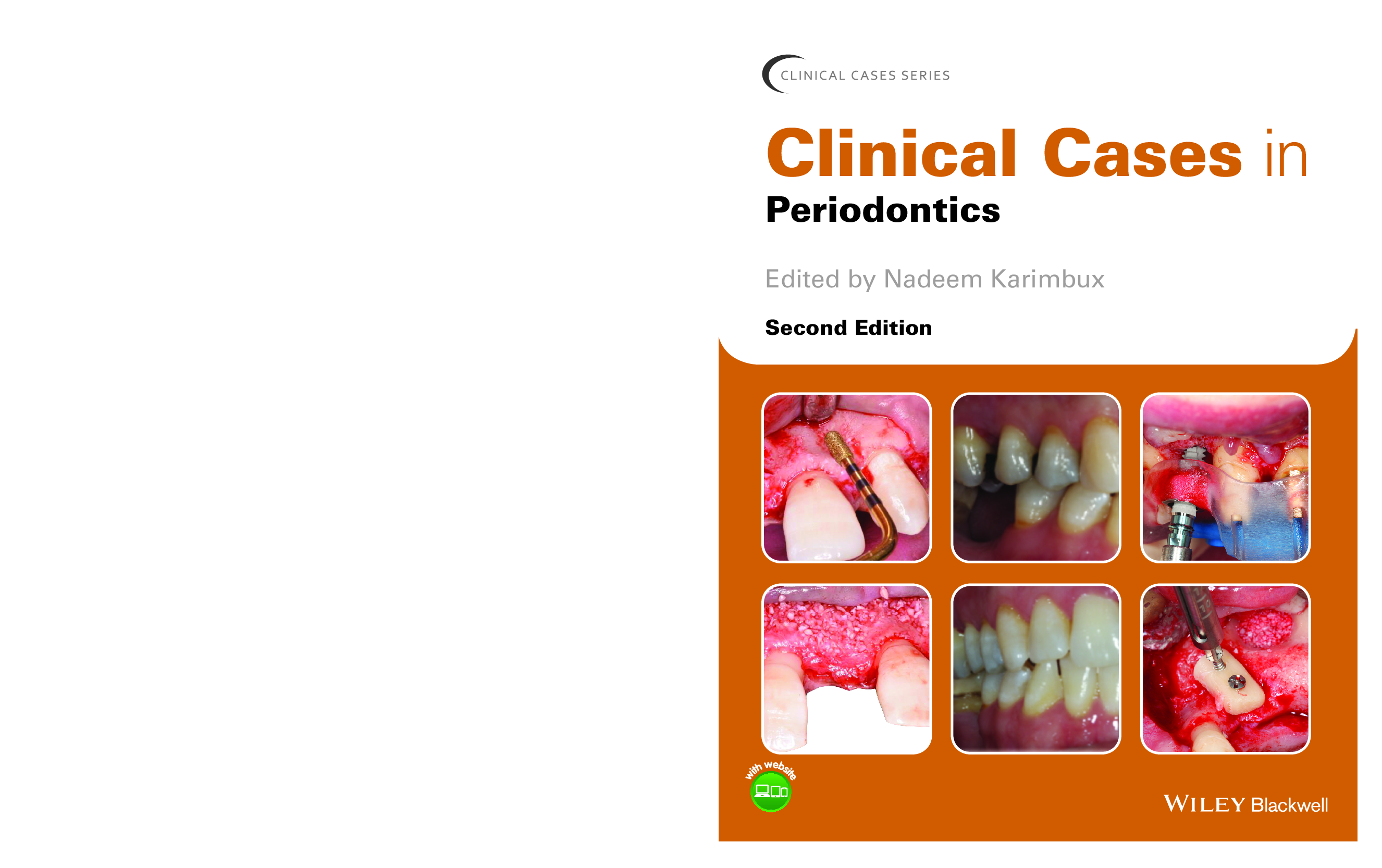 Preview image for [eBook] [PDF] CLINICAL CASES IN PERIODONTICS. 2nd Edition By NADEEM KARIMBUX