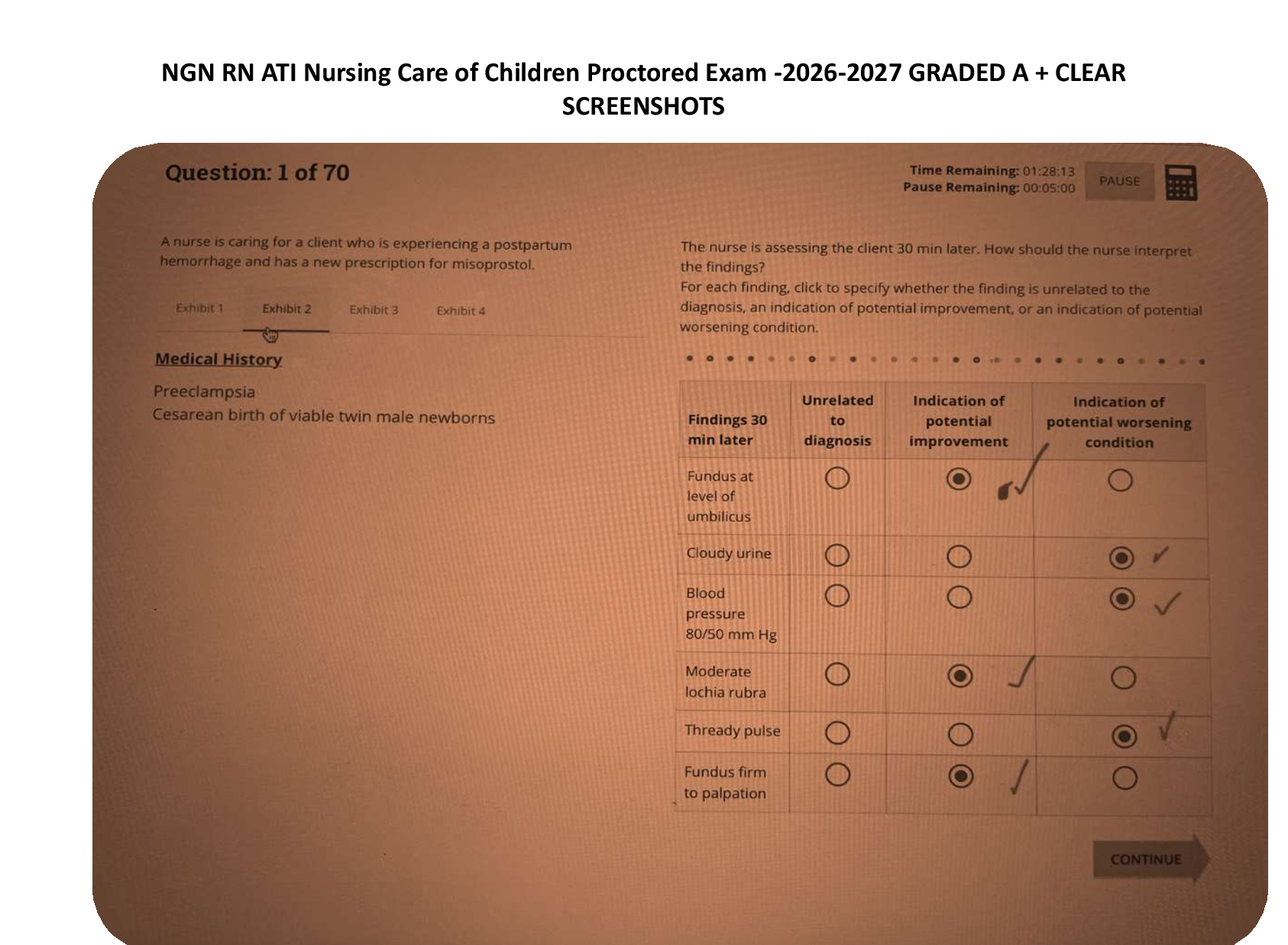 Preview image for NGN RN ATI Nursing Care of Children Proctored Exam -2026-2027 GRADED A + CLEAR  SCREENSHOTS