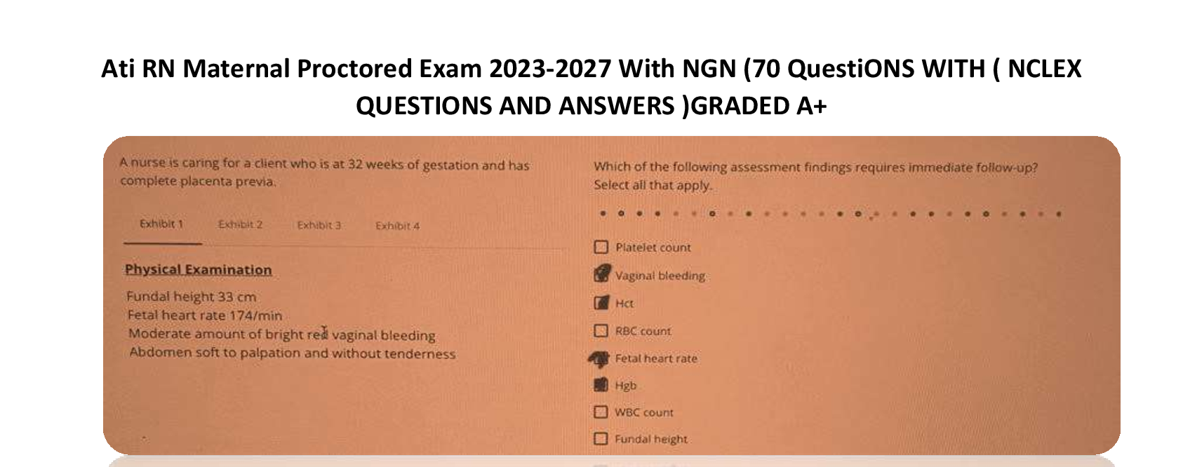 Preview image for Ati RN Maternal Proctored Exam 2023-2027 With NGN (70 QuestiONS WITH ( NCLEX  QUESTIONS AND ANSWERS )GRADED A+