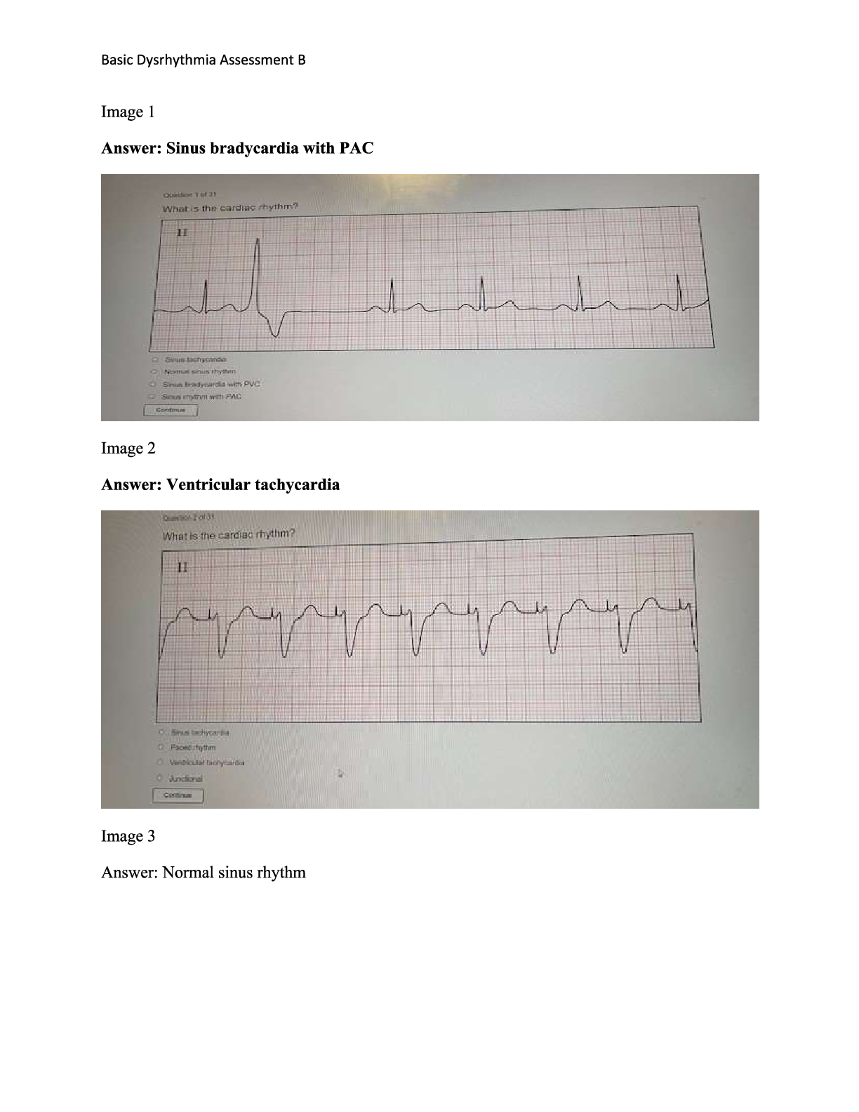 Preview image for Basic. Dysrhythmia Assessment