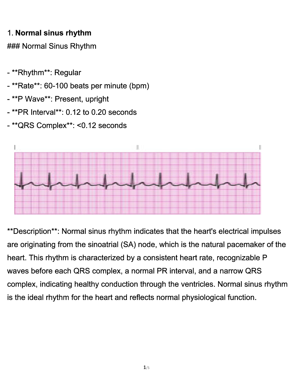 Preview image for Relias Advanced Dysrhythmia Exam Complete Step-by-Step Answers to All 52 Questions for the Relias Advanced Dysrhythmia Clinical Assessment.