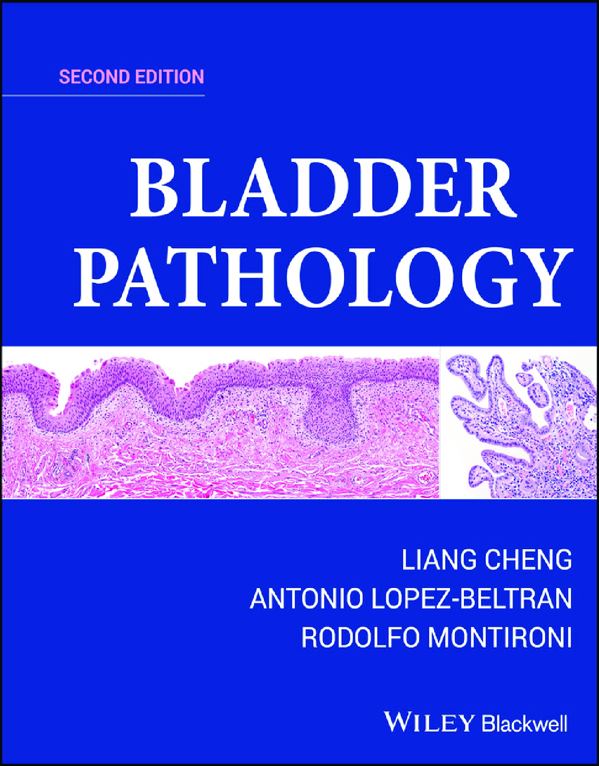 Preview image for [eBook] [PDF] Bladder Pathology 2nd Edition By Liang Cheng, Antonio Lopez-Beltran, Rodolfo Montironi