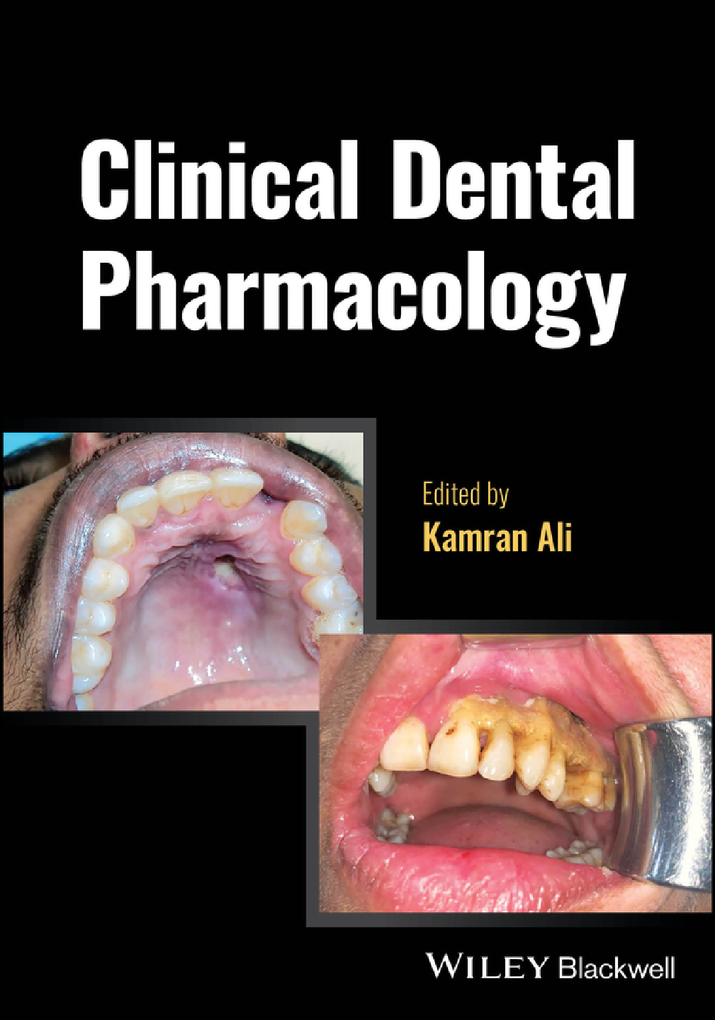 Recommended document preview for eBook PDF Clinical Dental Pharmacology 1st Edition By Kamran Ali