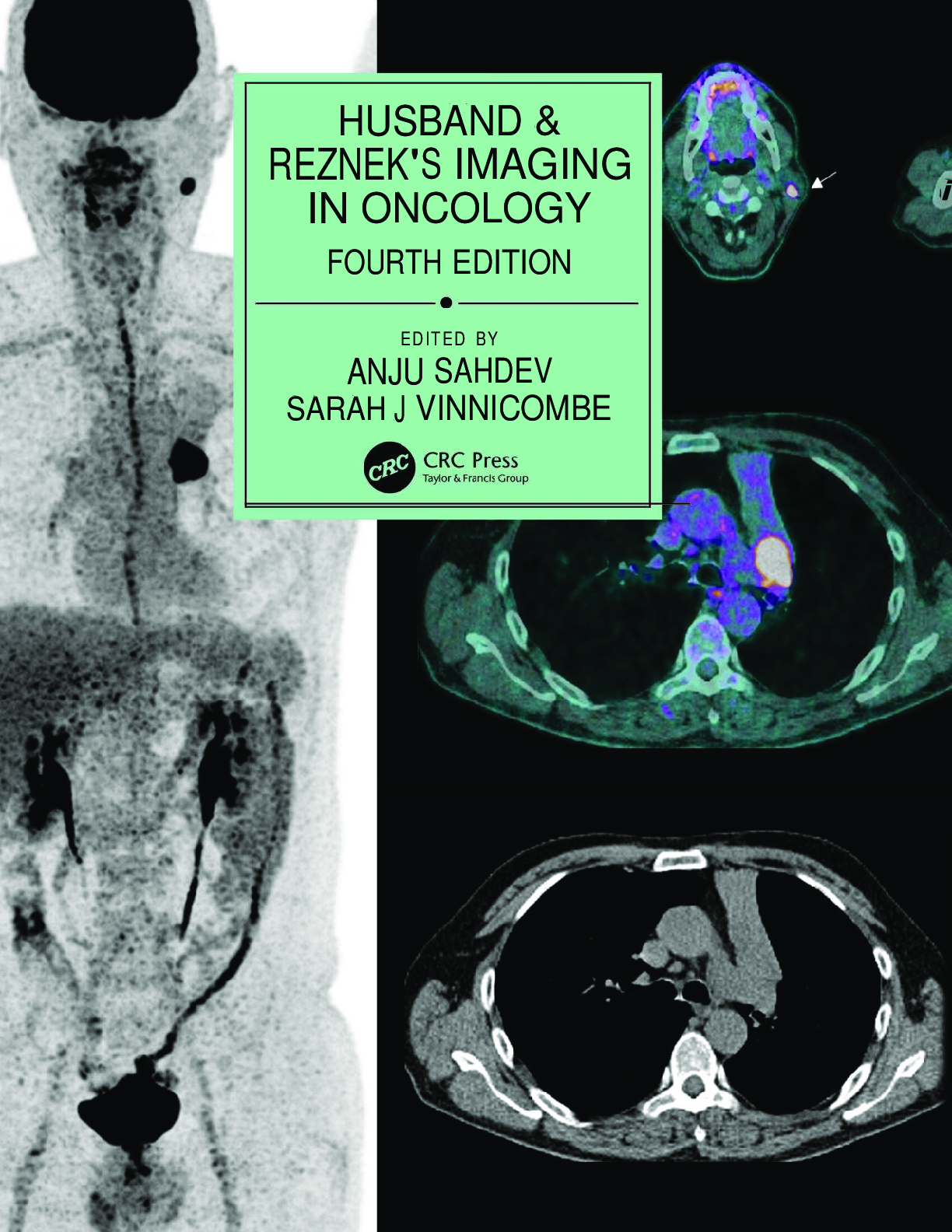 Preview image for PDF(eBook) Husband & Reznek's Imaging in Oncology ,Anju Sahdev, Sarah J. Vinnicombe,4e