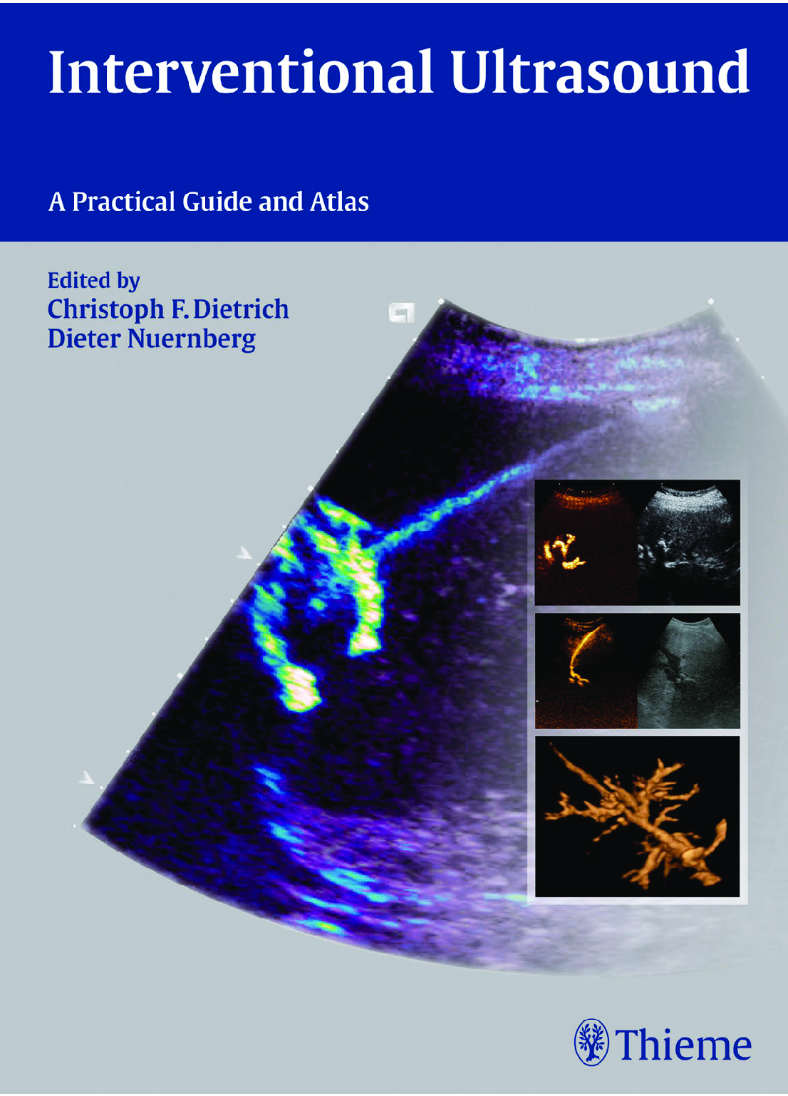 Preview image for PDF(eBook) Interventional Ultrasound ,Christoph Frank Dietrich ,Dieter Nürnberg,1e
