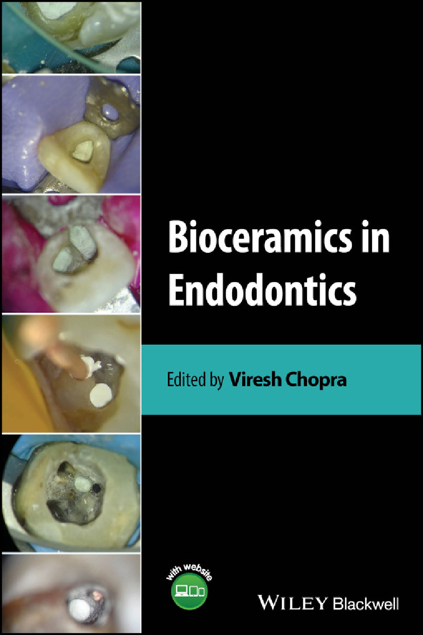 eBook PDF for Bioceramics in Endodontics 1st Edition By Viresh Chopra