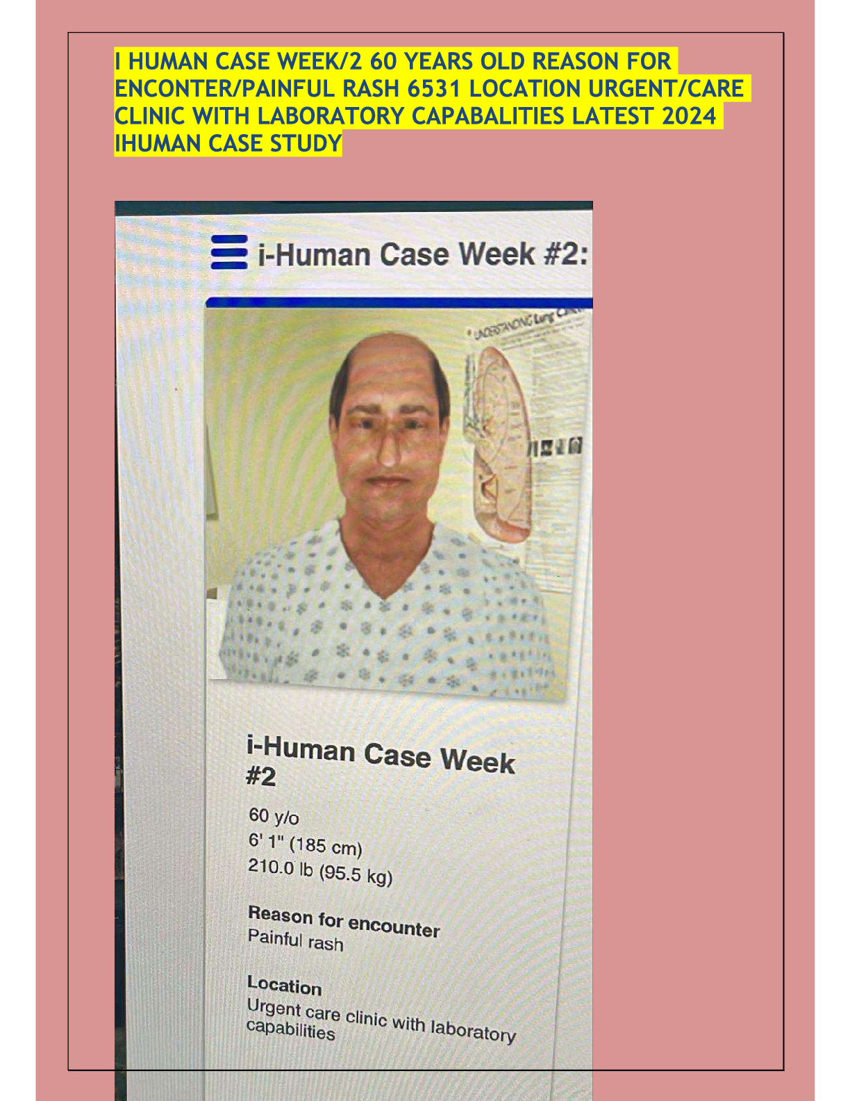 Preview image for I am a human case study for week 2, aged 60 years. The reason for the encounter is a painful rash. The location is an urgent care clinic with laboratory capabilities. This is the latest 2024 I-Human case study.