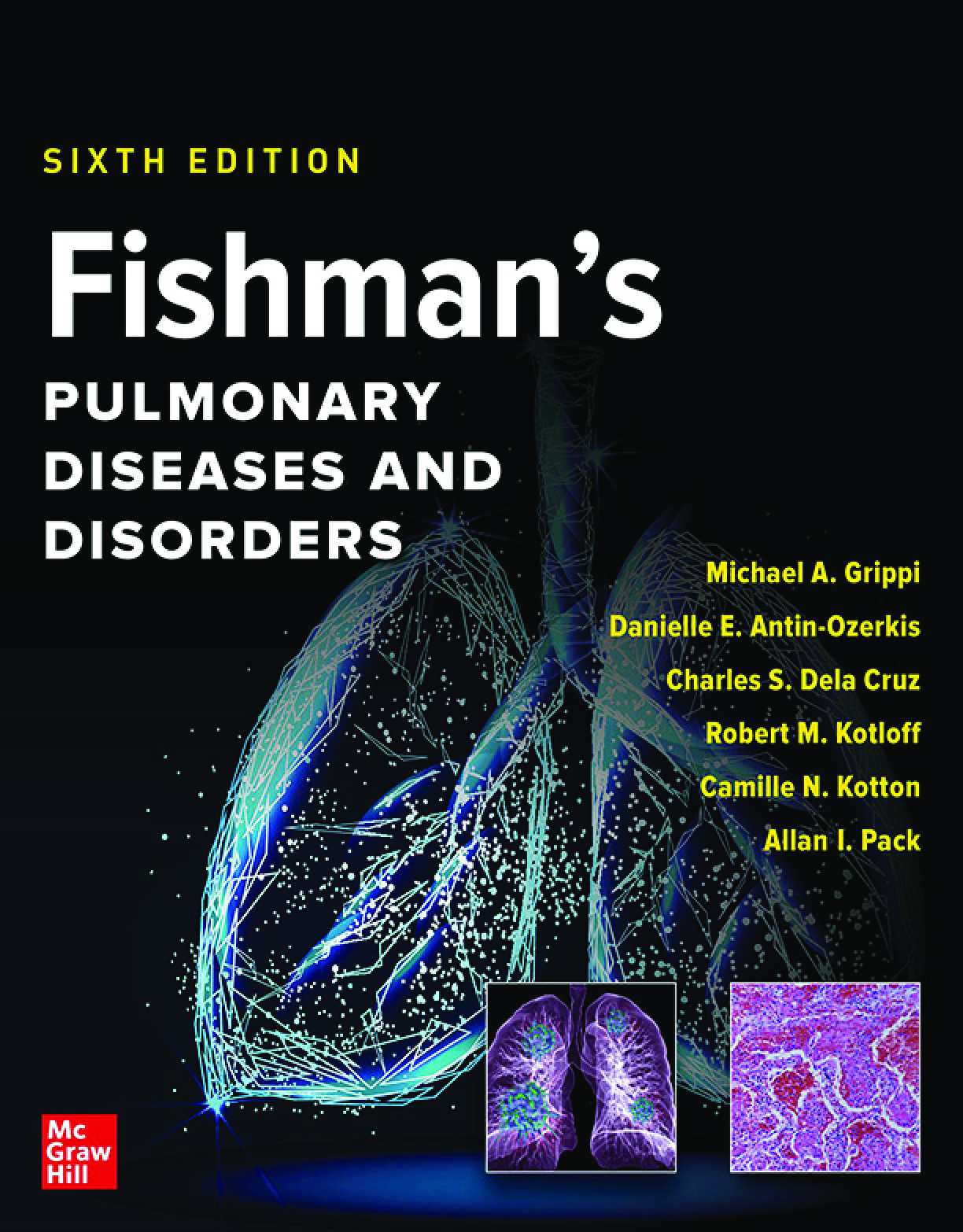 Preview image for [eBook-PDF] Fishman’s Pulmonary Diseases and Disorders, 2-Volume Set, Sixth Edition by Michael A. Grippi ISBN13: 9781260474060