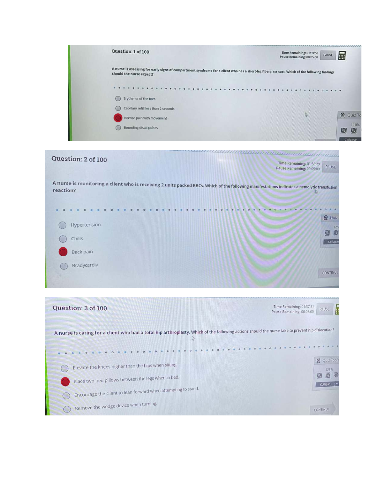 Preview image for This is the ATI RN Adult Medical-Surgical Proctored Exam 2023/2026 with NGN, containing 100 actual screenshot questions with 100% verified correct answers. All NGN formats and exam sections are included. Studying this ensures full coverage and guarantees a first-attempt pass.