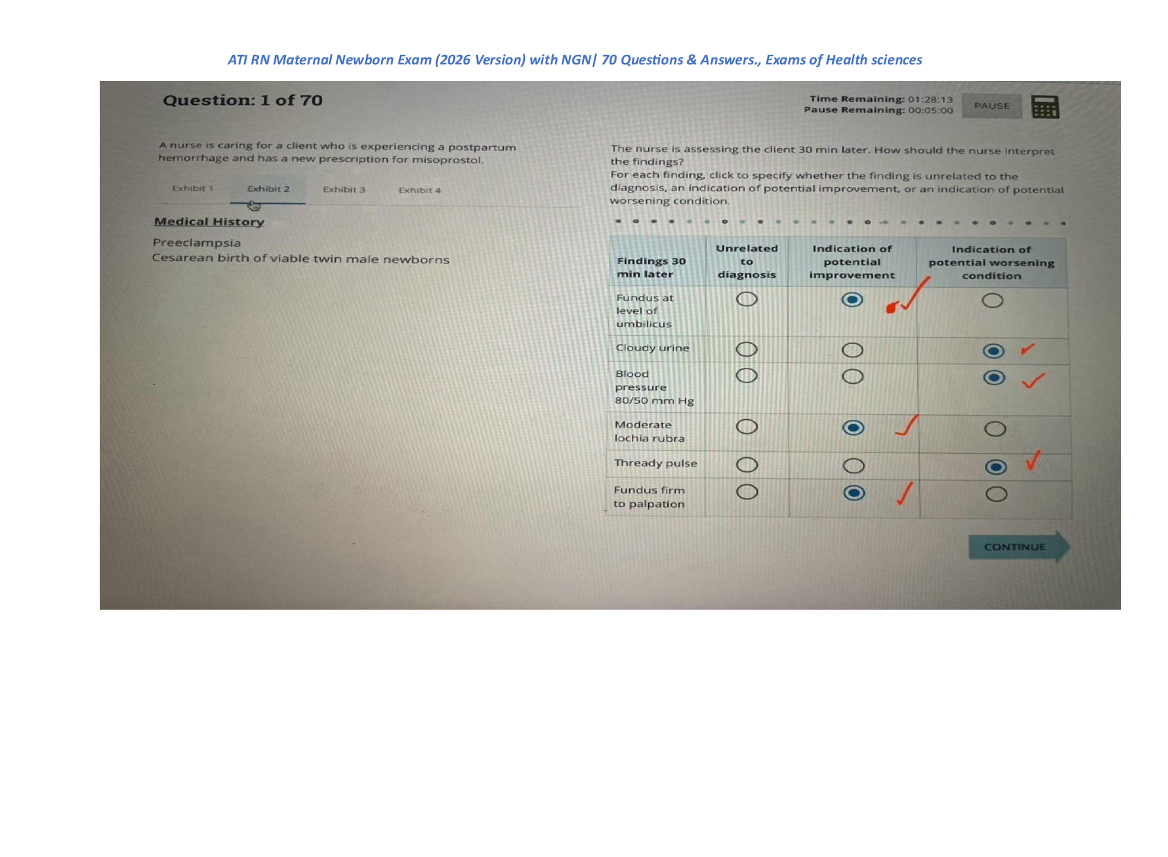 Preview image for ATI RN Maternal Newborn (OB)Proctored Exam 2023 with NGN (latest 2026 -Version) — 70 Actual Exam Questions & Detailed Answers for Guaranteed A+ on First Attempt