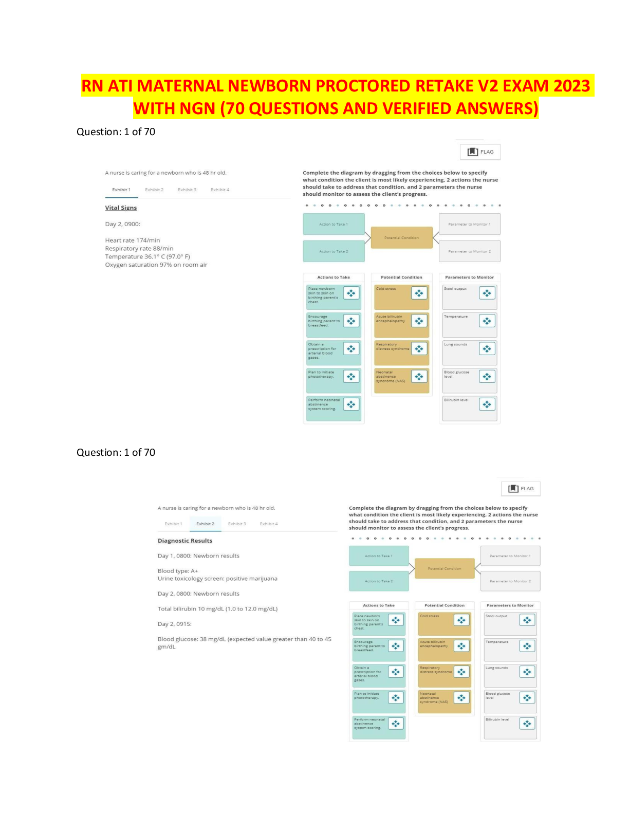 Recommended document preview for RN ATI MATERNAL NEWBORN PROCTORED RETAKE V2 EXAM 2023 WITH NGN (70 QUESTIONS AND VERIFIED ANSWERS)