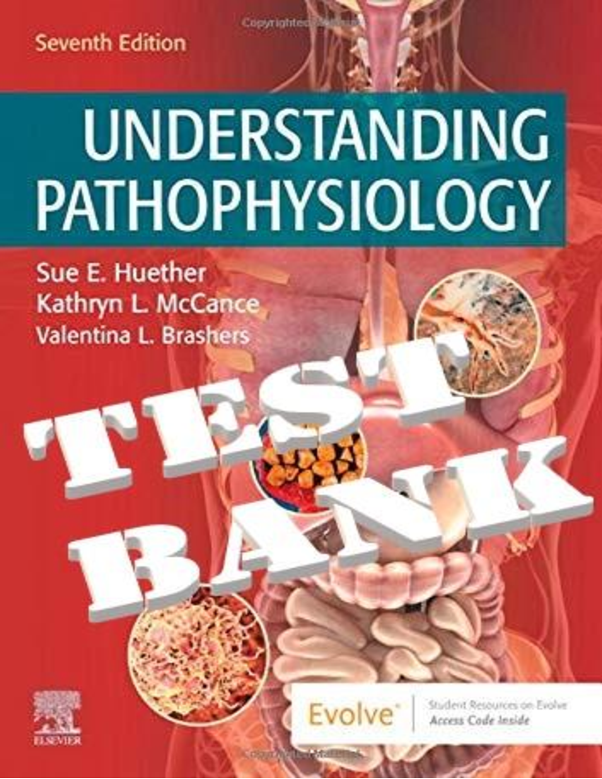 Recommended document preview for TEST BANK for Understanding Pathophysiology 7th Edition by Sue E. Huether, Kathryn L. McCance.