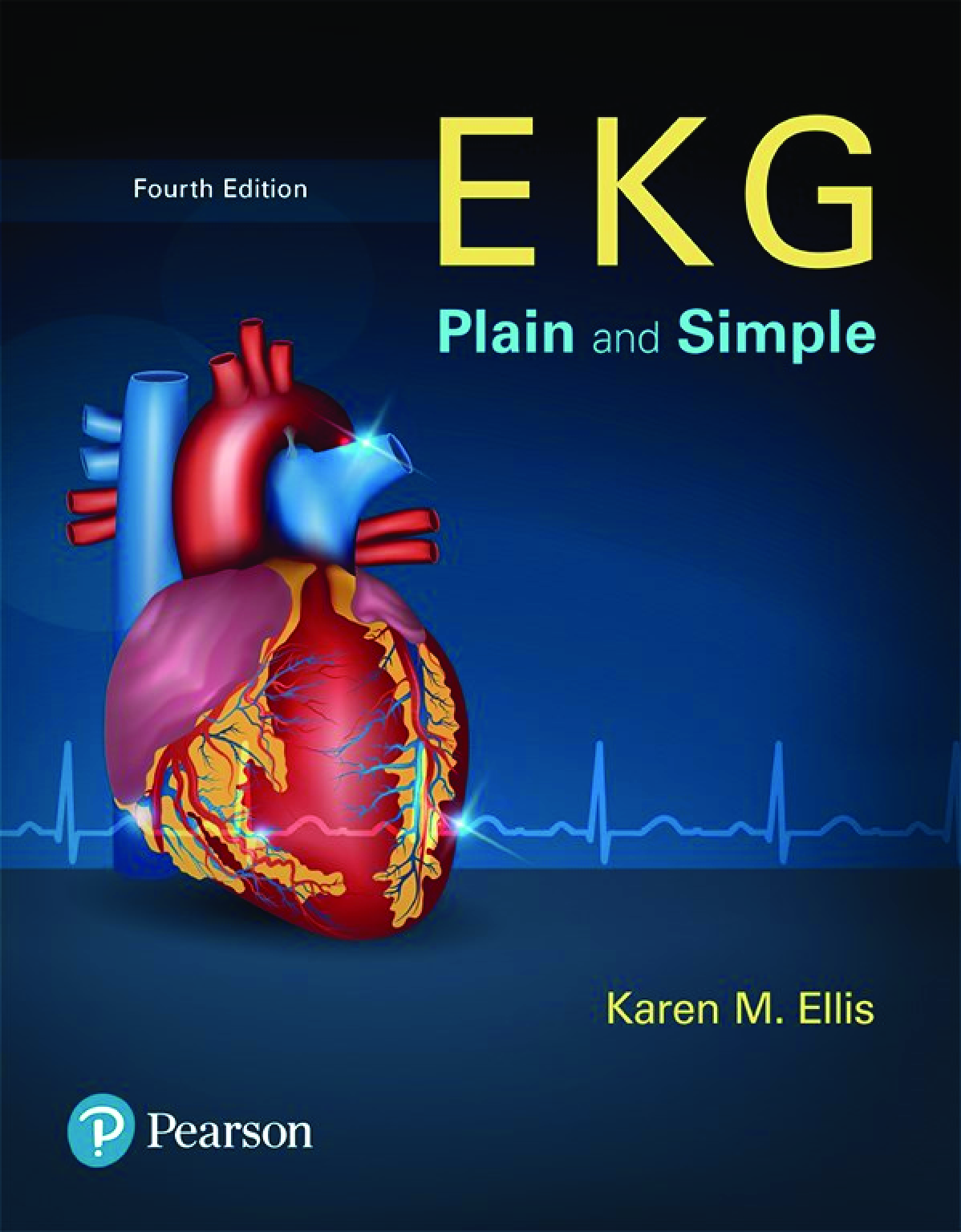 Preview of EKG Plain and Simple 4th Edition By Karen Ellis