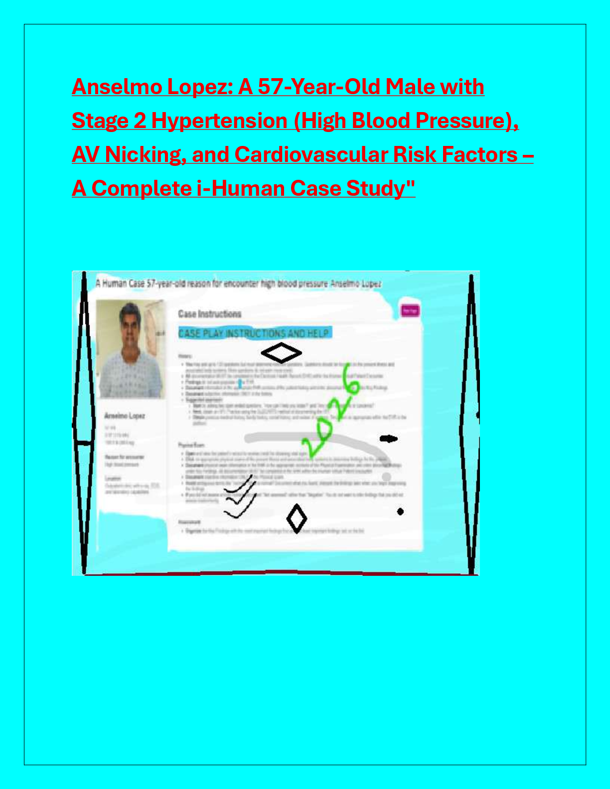 Recommended document preview for Anselmo Lopez: A 57-Year-Old Male with  Stage 2 Hypertension (High Blood Pressure),  AV Nicking, and Cardiovascular Risk Factors –  A Complete i-Human Case Study"
