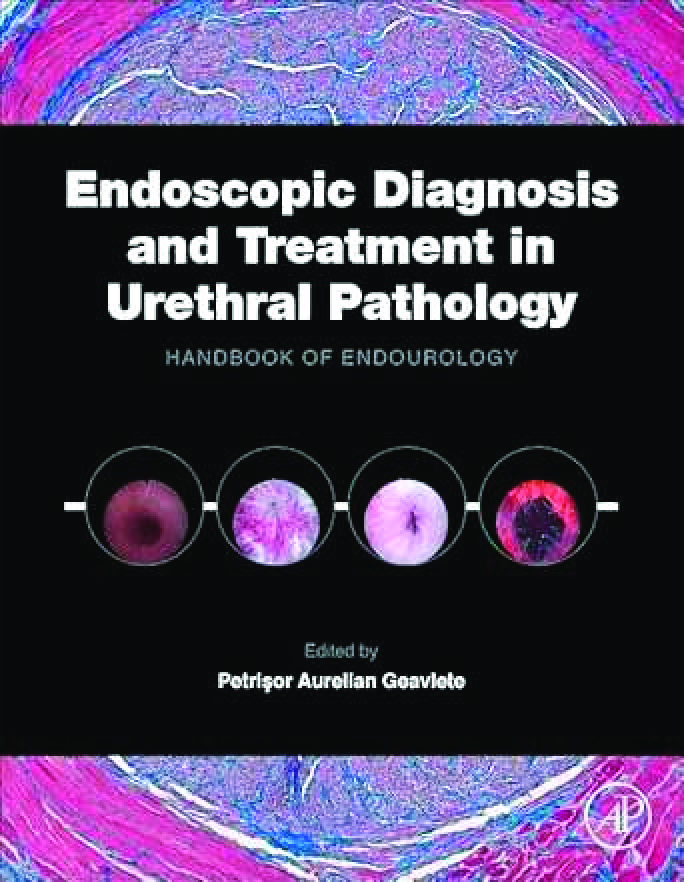 Recommended document preview for eBook PDF Endoscopic Diagnosis and Treatment in Urethral Pathology 1st Edition By Petrisor Aurelian Geavlete