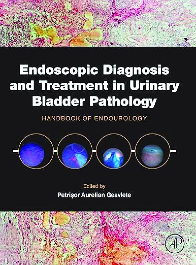Recommended document preview for eBook PDF Endoscopic Diagnosis and Treatment in Urinary Bladder Pathology Handbook of Endourology 1st Edition By Petrisor Aurelian Geavlete