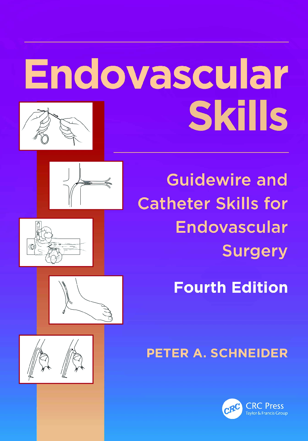 Recommended document preview for eBook PDF Endovascular Skills Guidewire and Catheter Skills for Endovascular Surgery 4th Edition By Peter Schneider