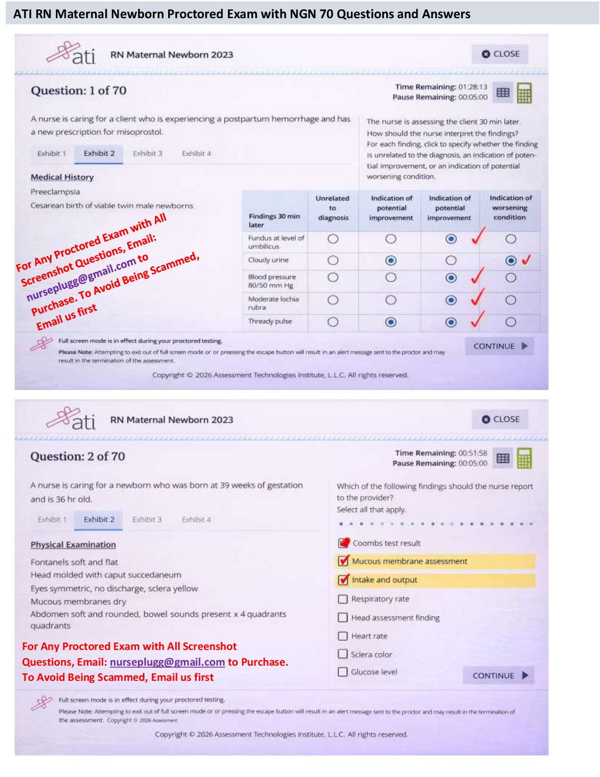 Recommended document preview for Gain access to the ATI RN Maternal Newborn 2023-2026 Proctored Exam with NGN featuring 70 questions and answers.