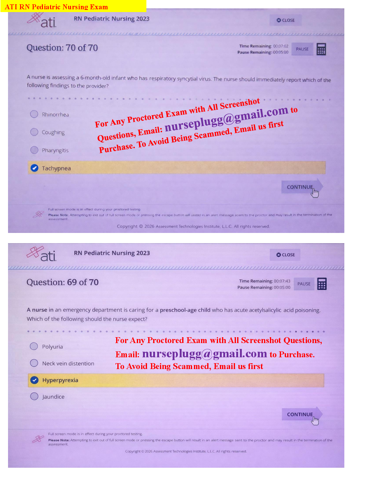 Preview of Access the ATI RN Pediatric Nursing 2023-2026 Proctored Exam with NGN featuring 70 questio