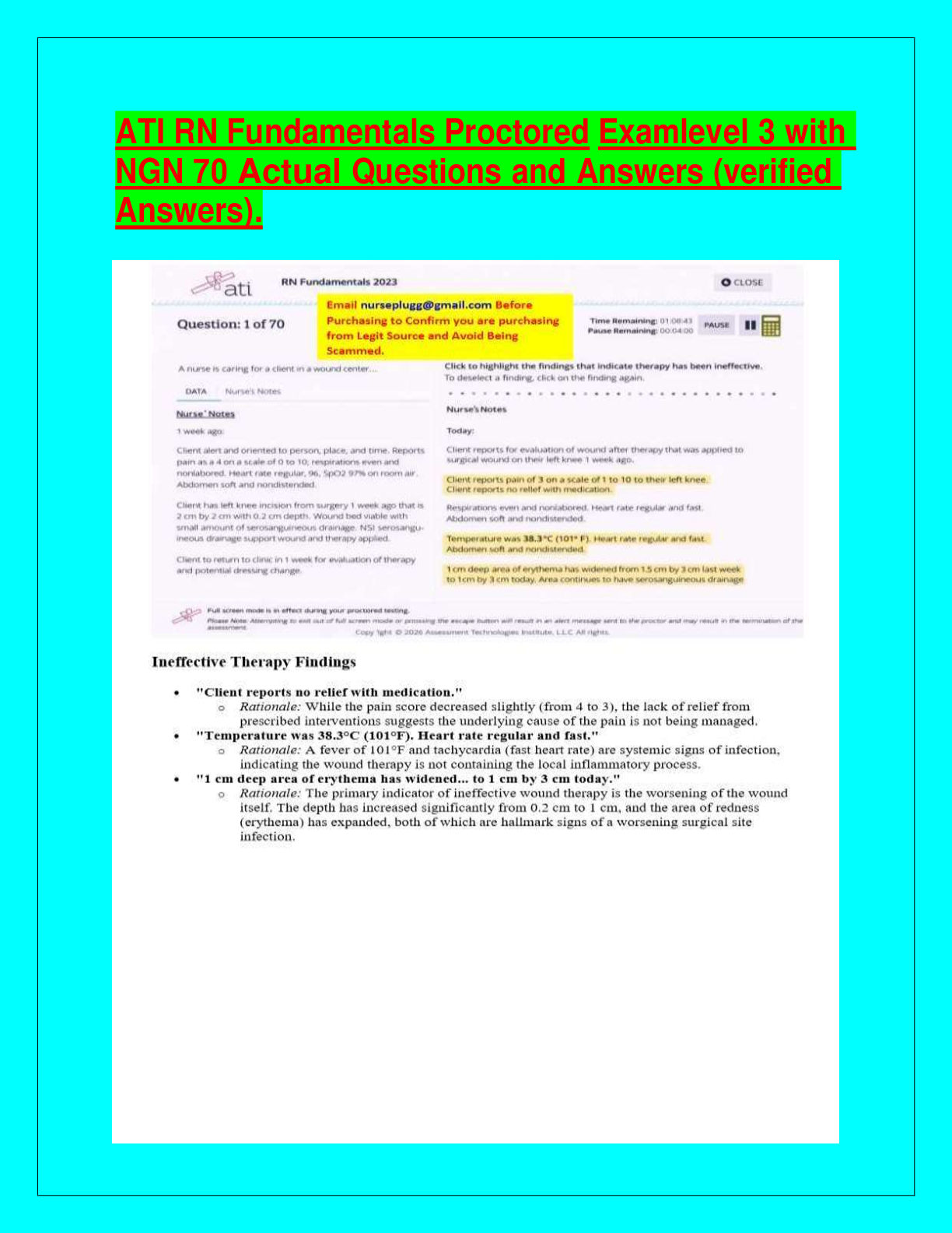 Recommended document preview for ATI RN Fundamentals Proctored Examlevel 3 with NGN 70 Actual Questions and Answers (verified Answers).
