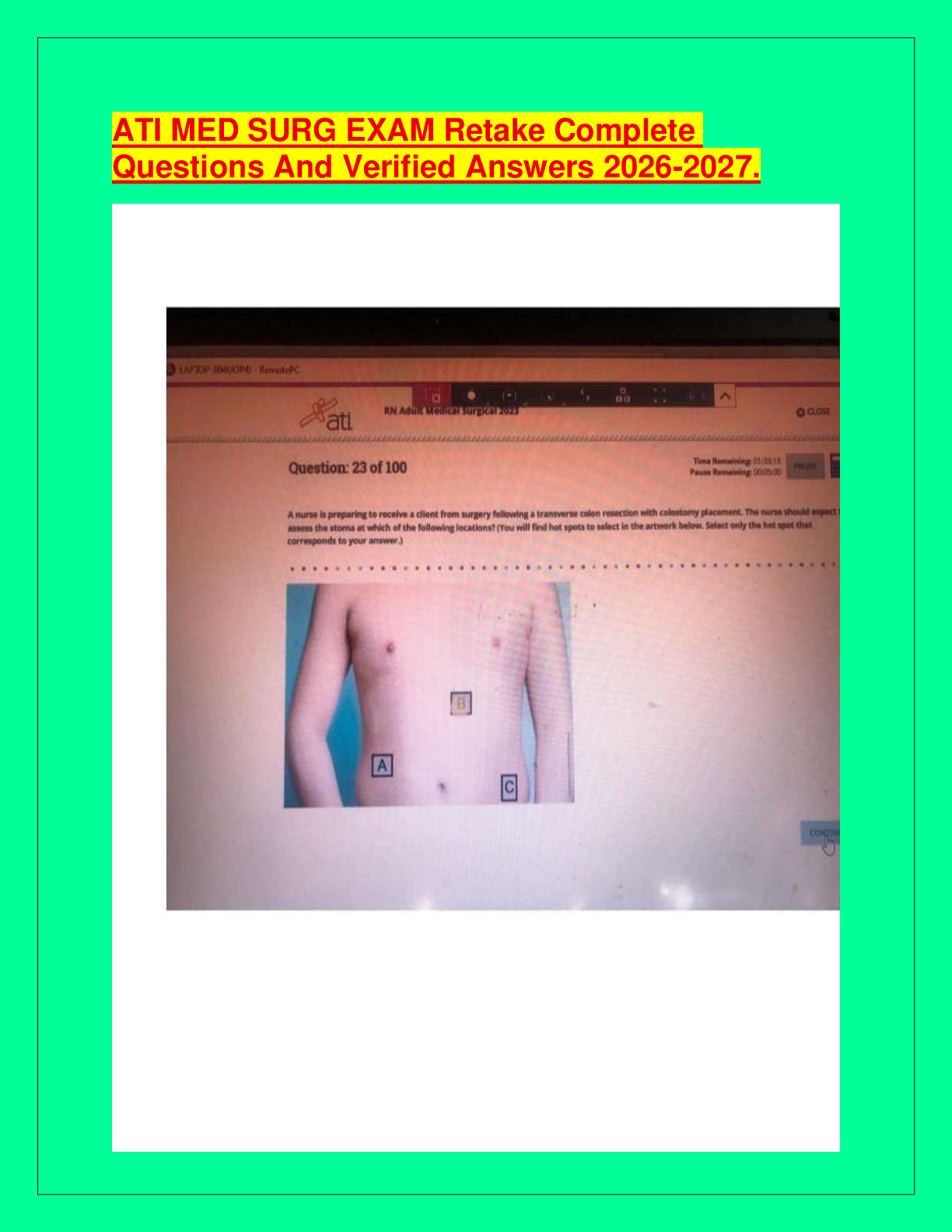 ATI MED SURG EXAM Retake Complete Questions And Verified Answers 2026-2027.