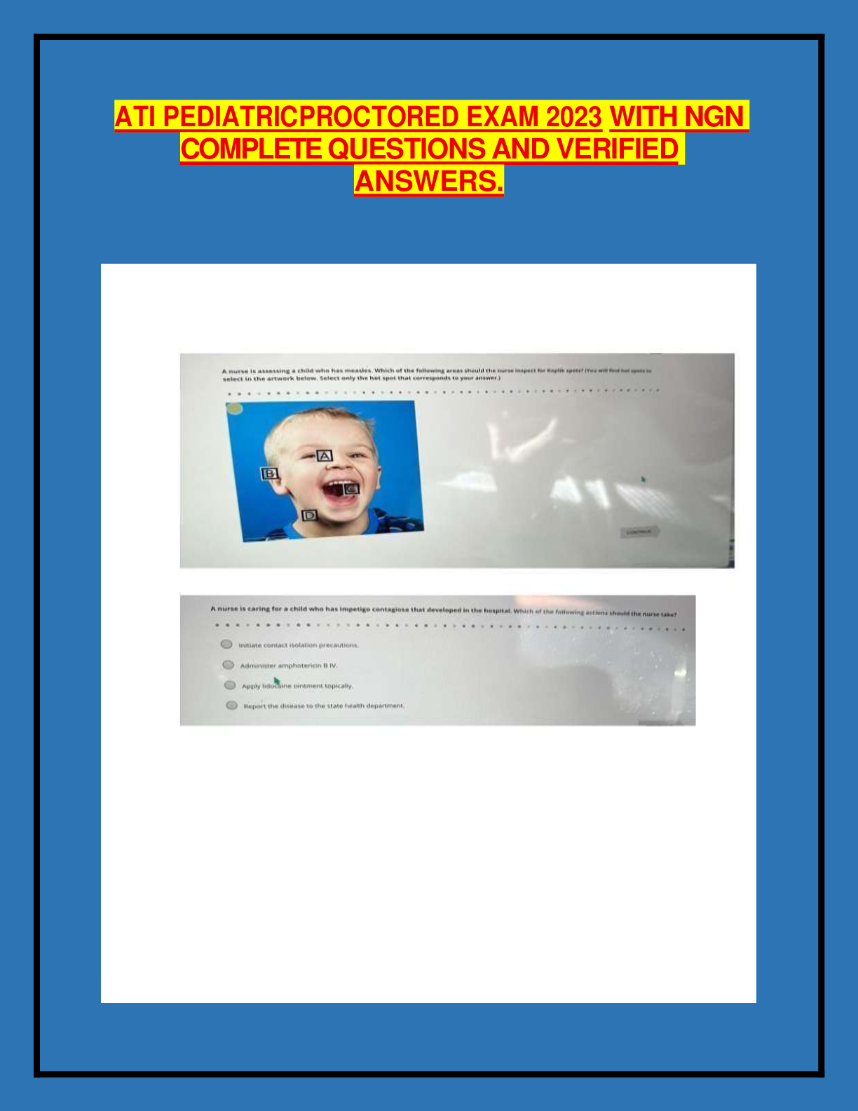 ATI PEDIATRICPROCTORED EXAM 2023 WITH NGN COMPLETE QUESTIONS AND VERIFIED ANSWERS.