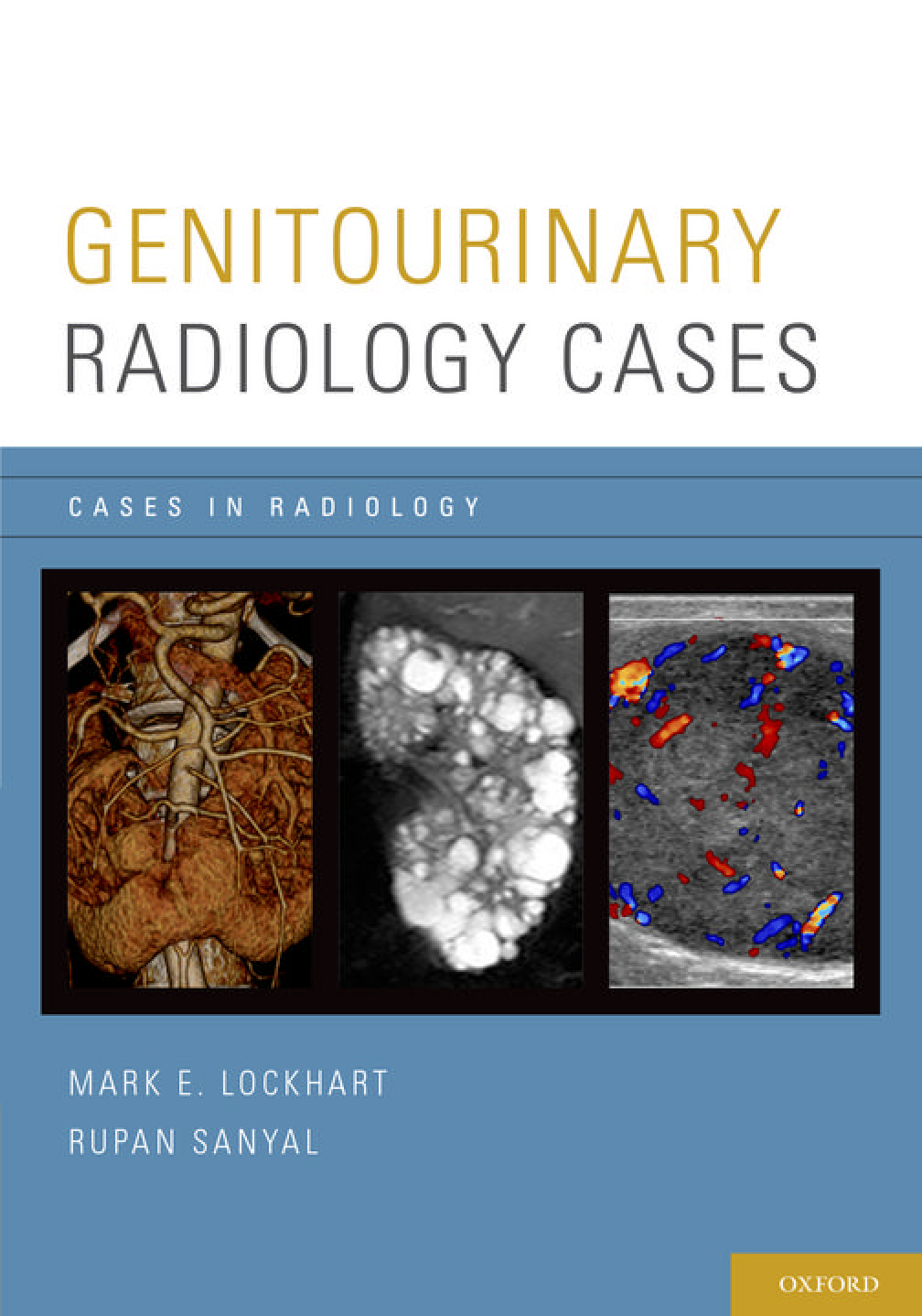 Recommended document preview for eBook PDF Genitourinary Radiology Cases Cases in Radiology 1st Edition By Mark E. Lockhart, Rupan Sanyal