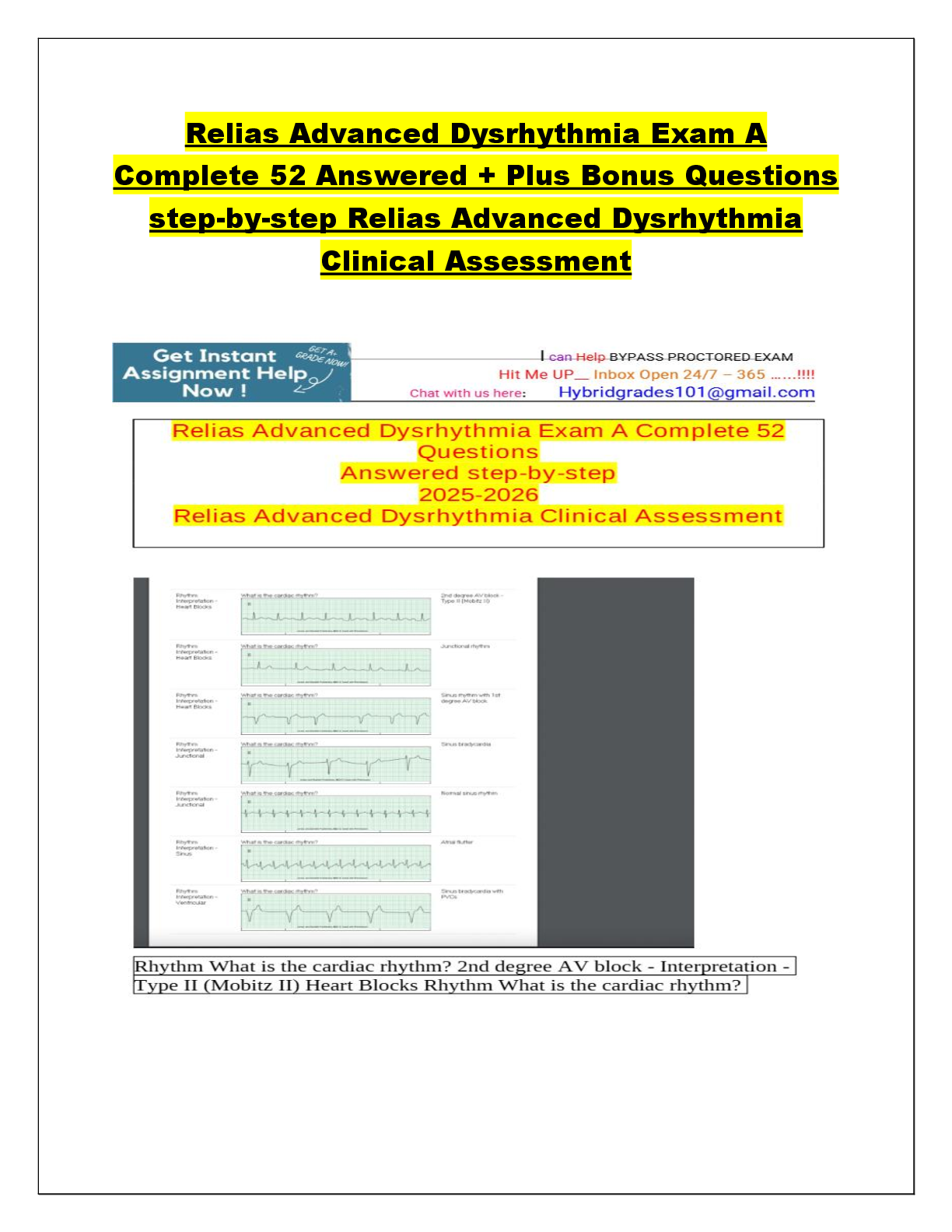 Recommended document preview for Relias Advanced Dysrhythmia Exam A Complete 52 Answered + Plus Bonus Questions  step-by-step Relias Advanced Dysrhythmia Clinical Assessment