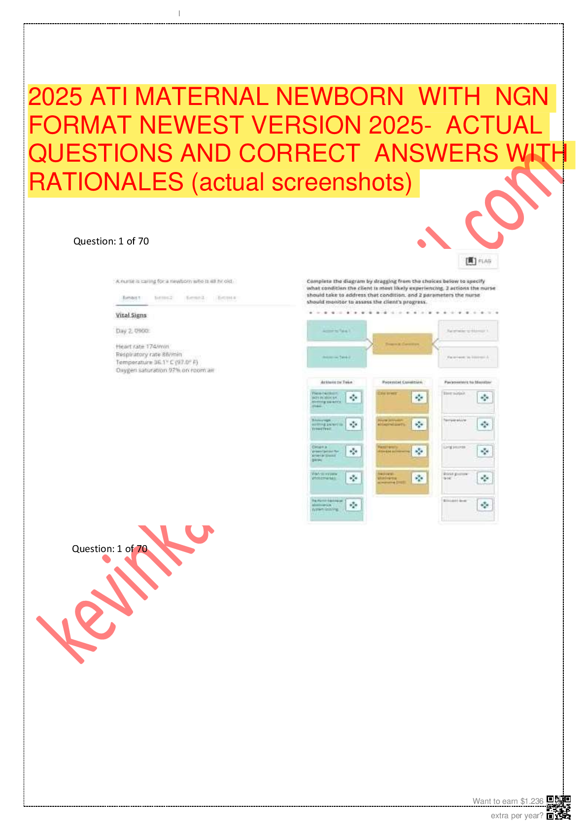 Recommended document preview for 2025 ATI MATERNAL NEWBORN  WITH  NGN  FORMAT NEWEST VERSION 2025-  ACTUAL  QUESTIONS AND CORRECT  ANSWERS WITH  RATIONALES (actual screenshots)