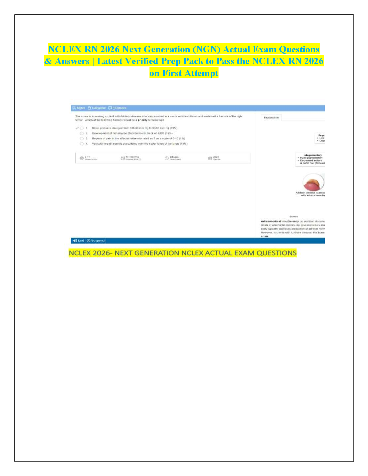 Preview of NCLEX RN 2026 Next Generation (NGN) Actual Exam Questions  & Answers | Latest Verified Pre