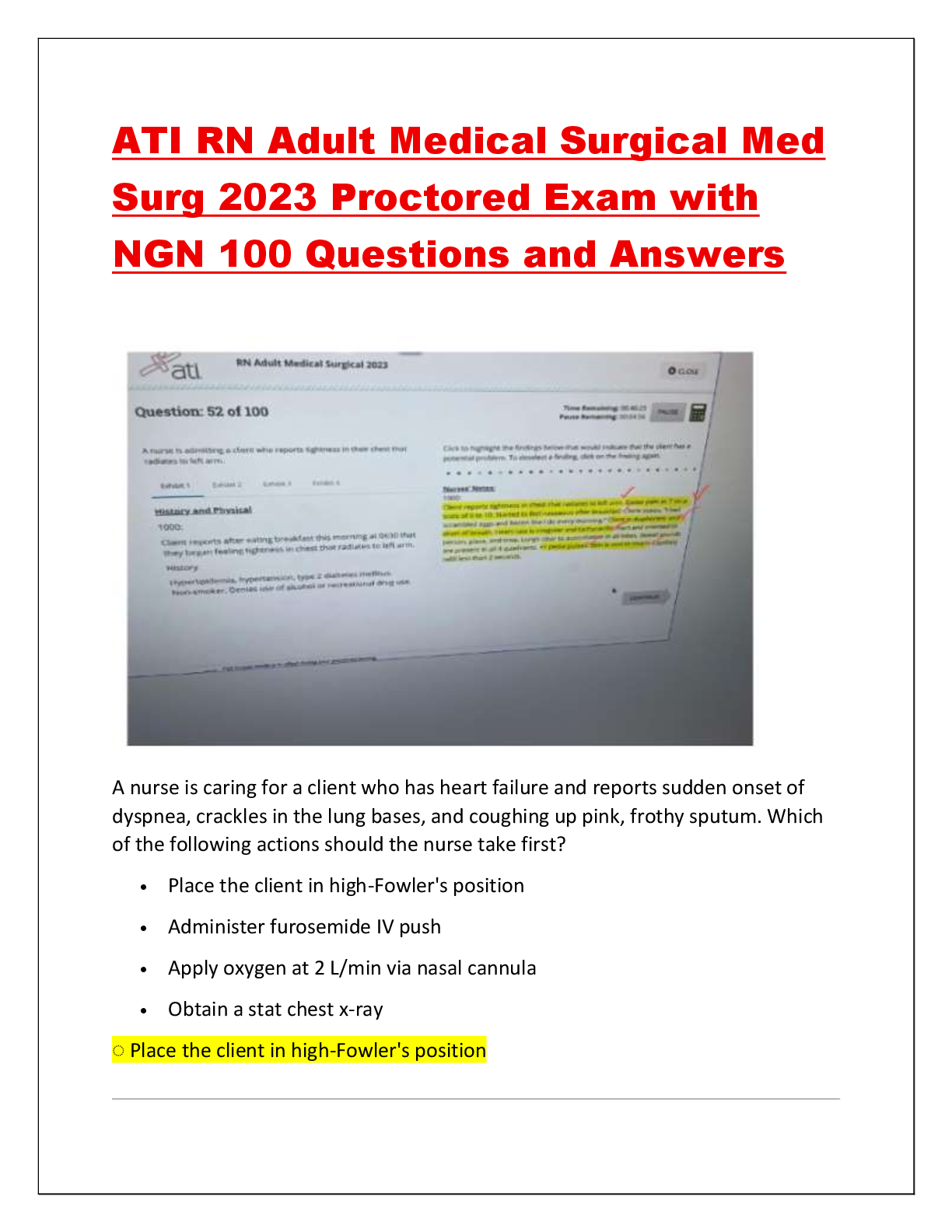 Recommended document preview for ATI RN Adult Medical Surgical Med Surg 2023 Proctored Exam with NGN 100 Questions and Answers