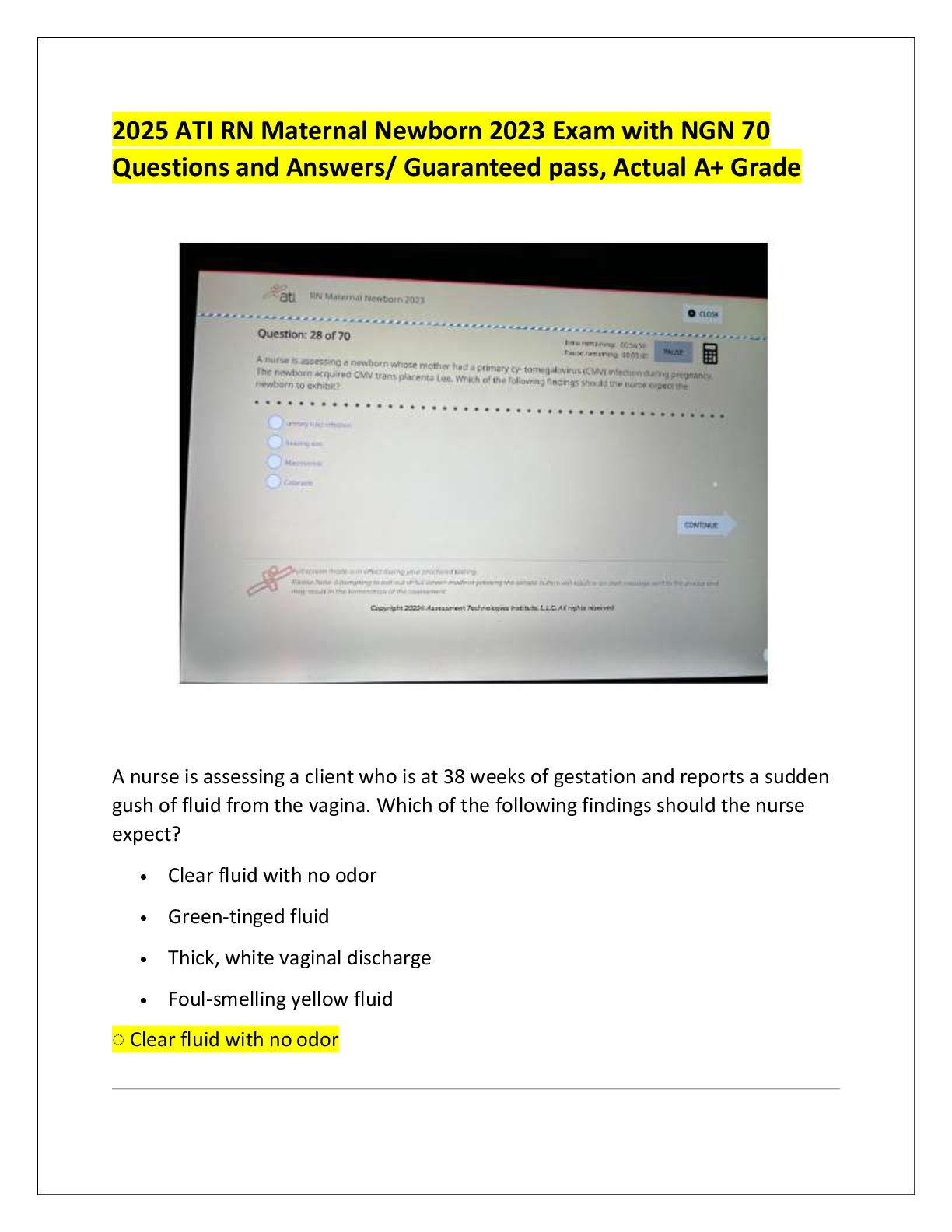 Preview of 2025 ATI RN Maternal Newborn 2023 Exam with NGN 70  Questions and Answers/ Guaranteed pass