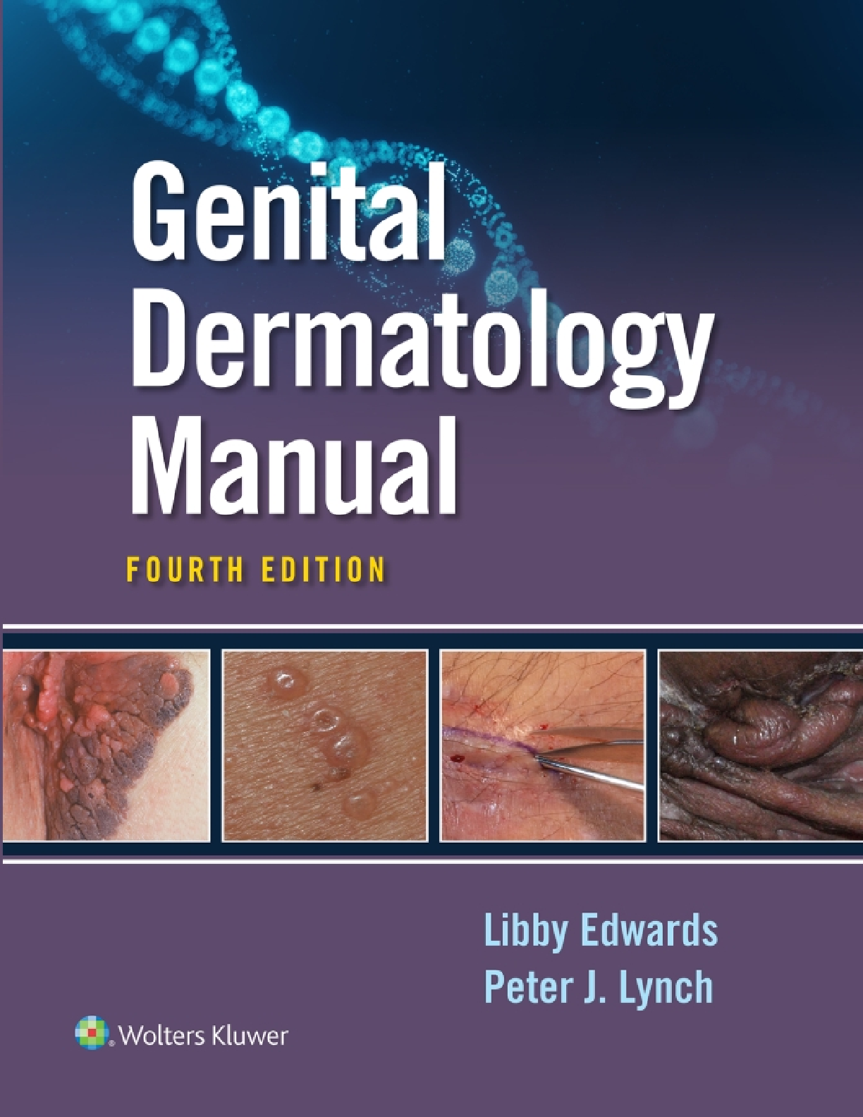 Preview of eBook PDF Genital Dermatology Manual 4th Edition By Libby Edwards, Peter Lynch